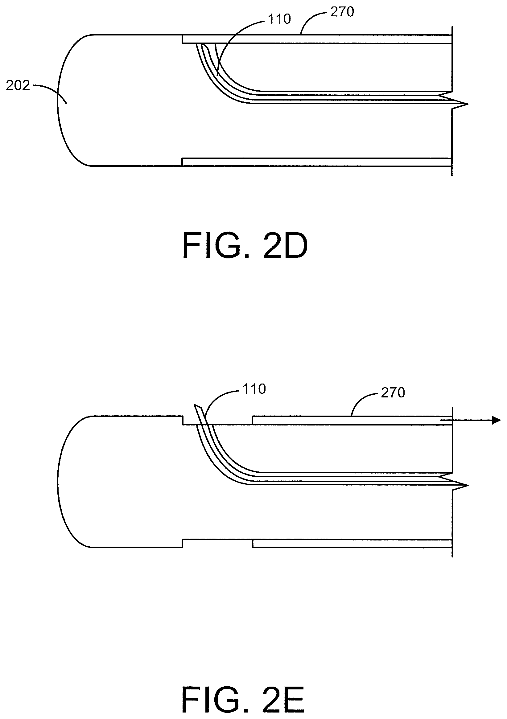 Patent US12496469 Figure 4 – Devices and methods for endoluminal delivery of either fluid or energy for denervation
