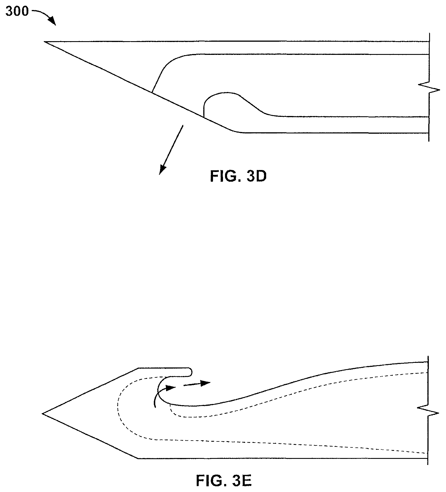 Patent US12496469 Figure 6 – Devices and methods for endoluminal delivery of either fluid or energy for denervation