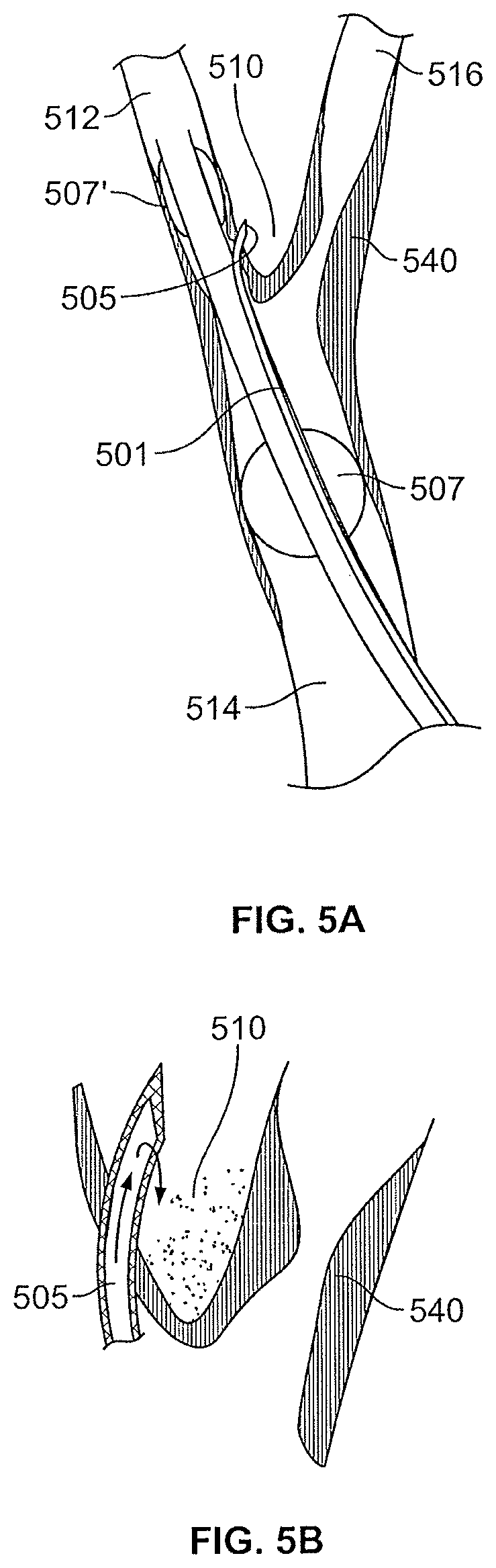 Patent US12496469 Figure 8 – Devices and methods for endoluminal delivery of either fluid or energy for denervation
