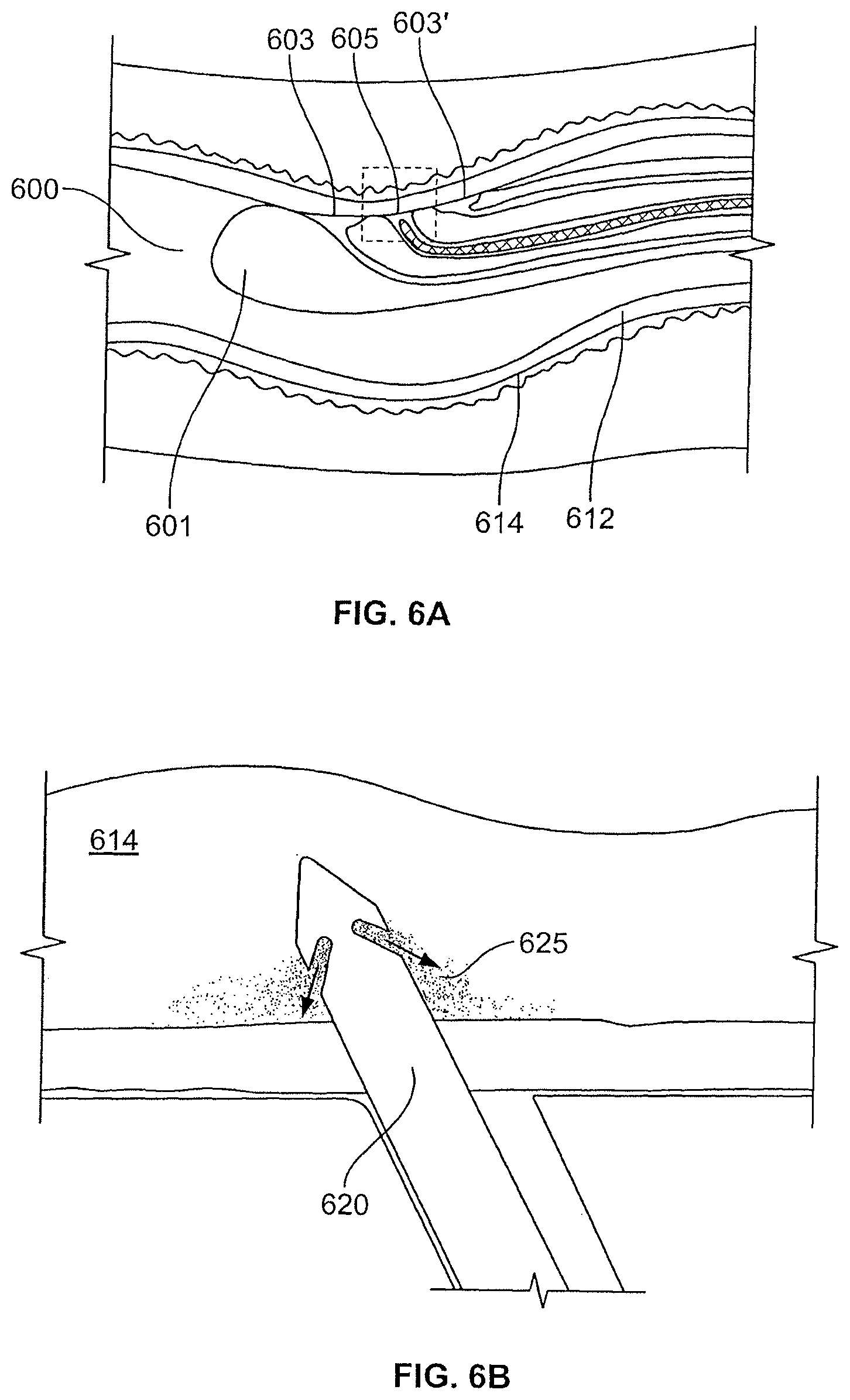 Patent US12496469 Figure 9 – Devices and methods for endoluminal delivery of either fluid or energy for denervation
