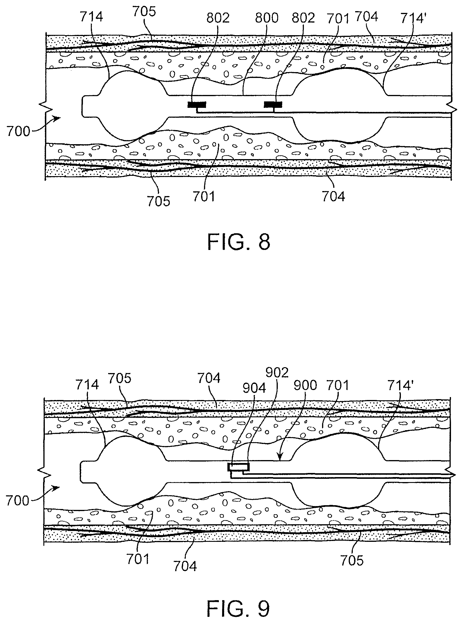 Patent US12496469 Figure 13 – Devices and methods for endoluminal delivery of either fluid or energy for denervation