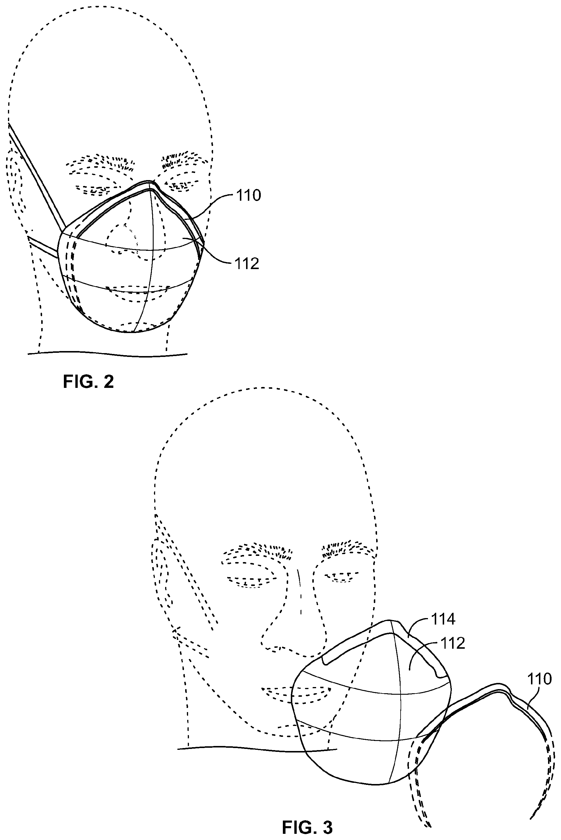 Patent US12496473 Figure 3 – Systems and methods for producing user-customized facial masks and portions thereof