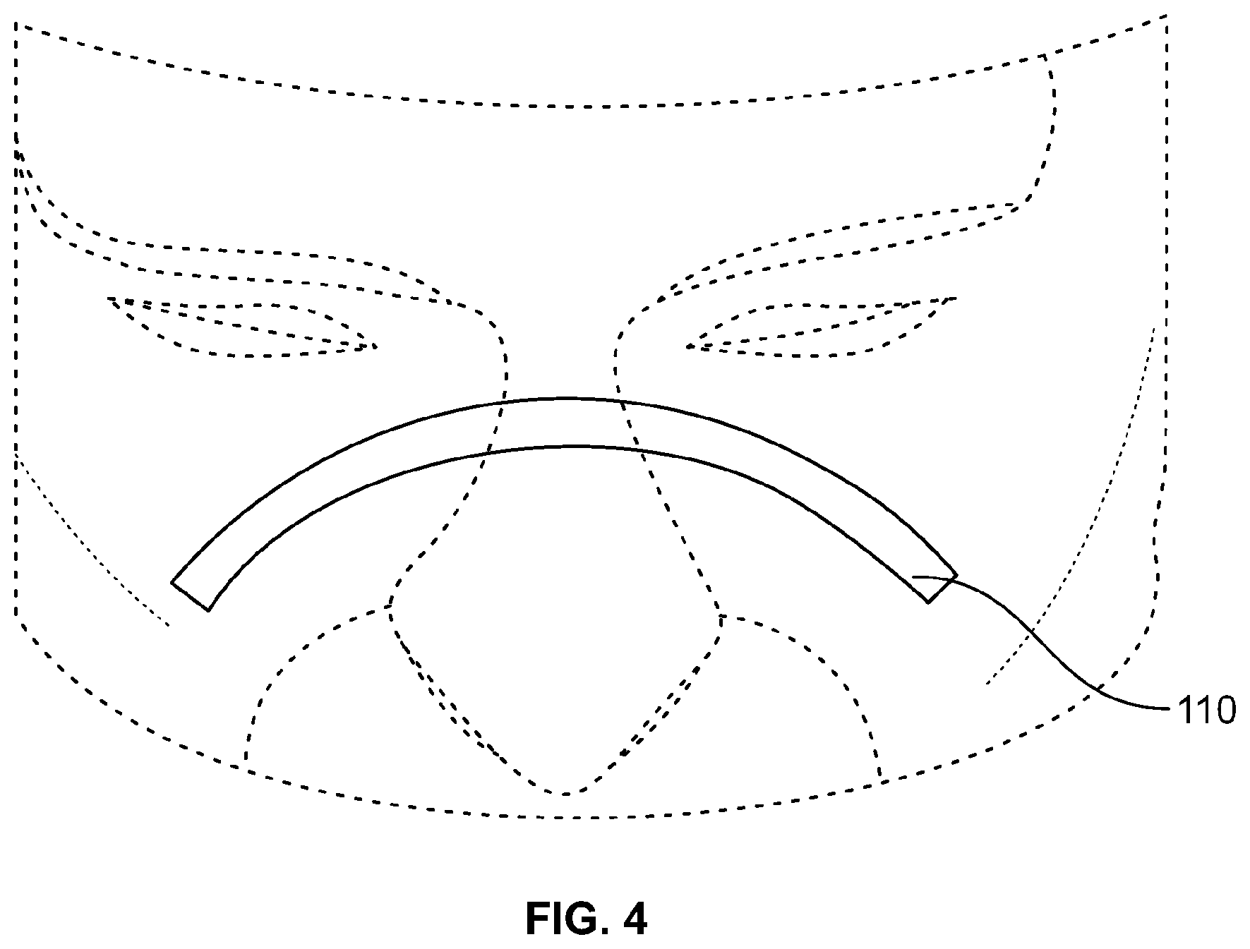 Patent US12496473 Figure 4 – Systems and methods for producing user-customized facial masks and portions thereof