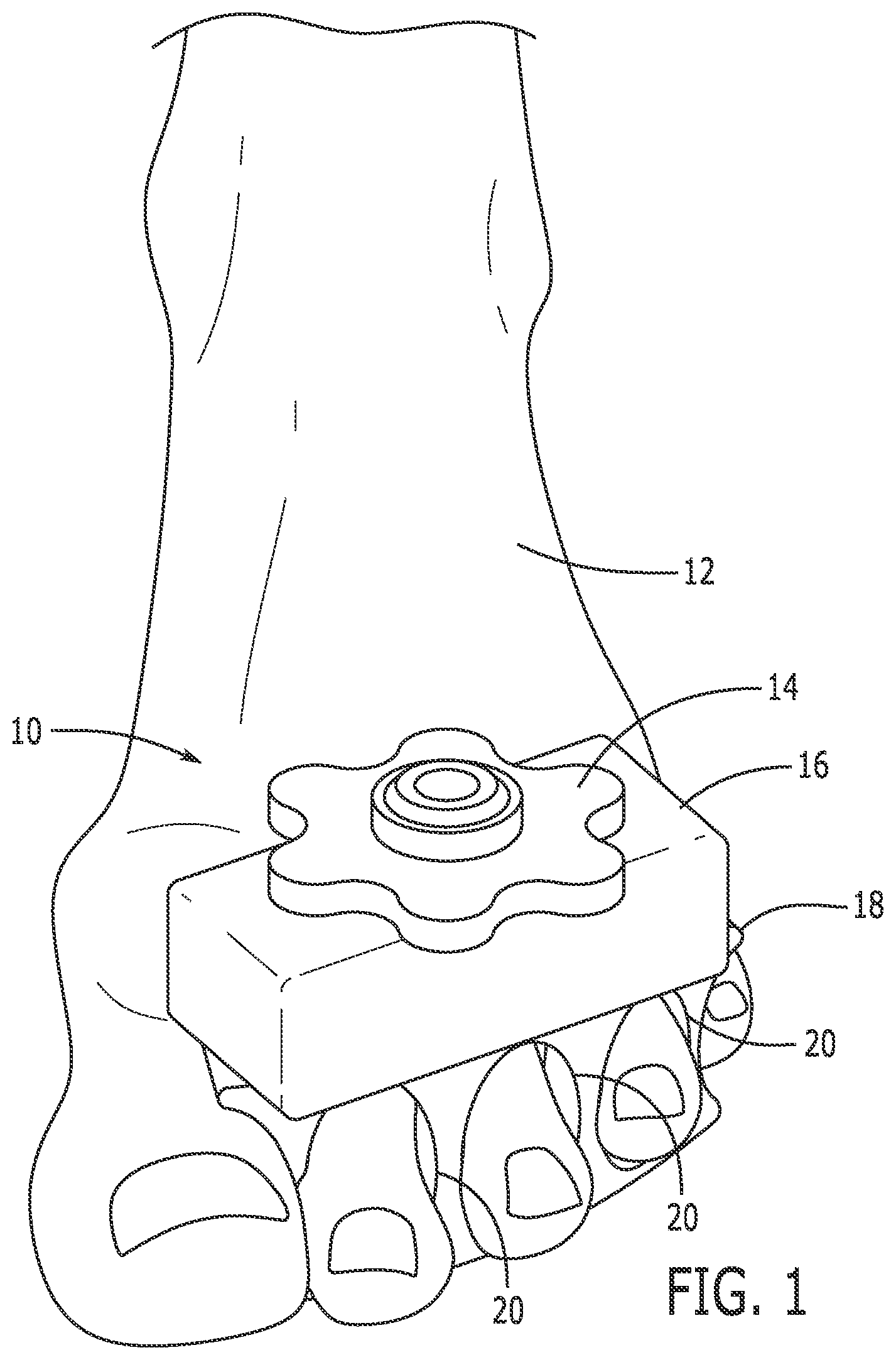 Patent US12496485 Figure 1 – Fitness device for lower body