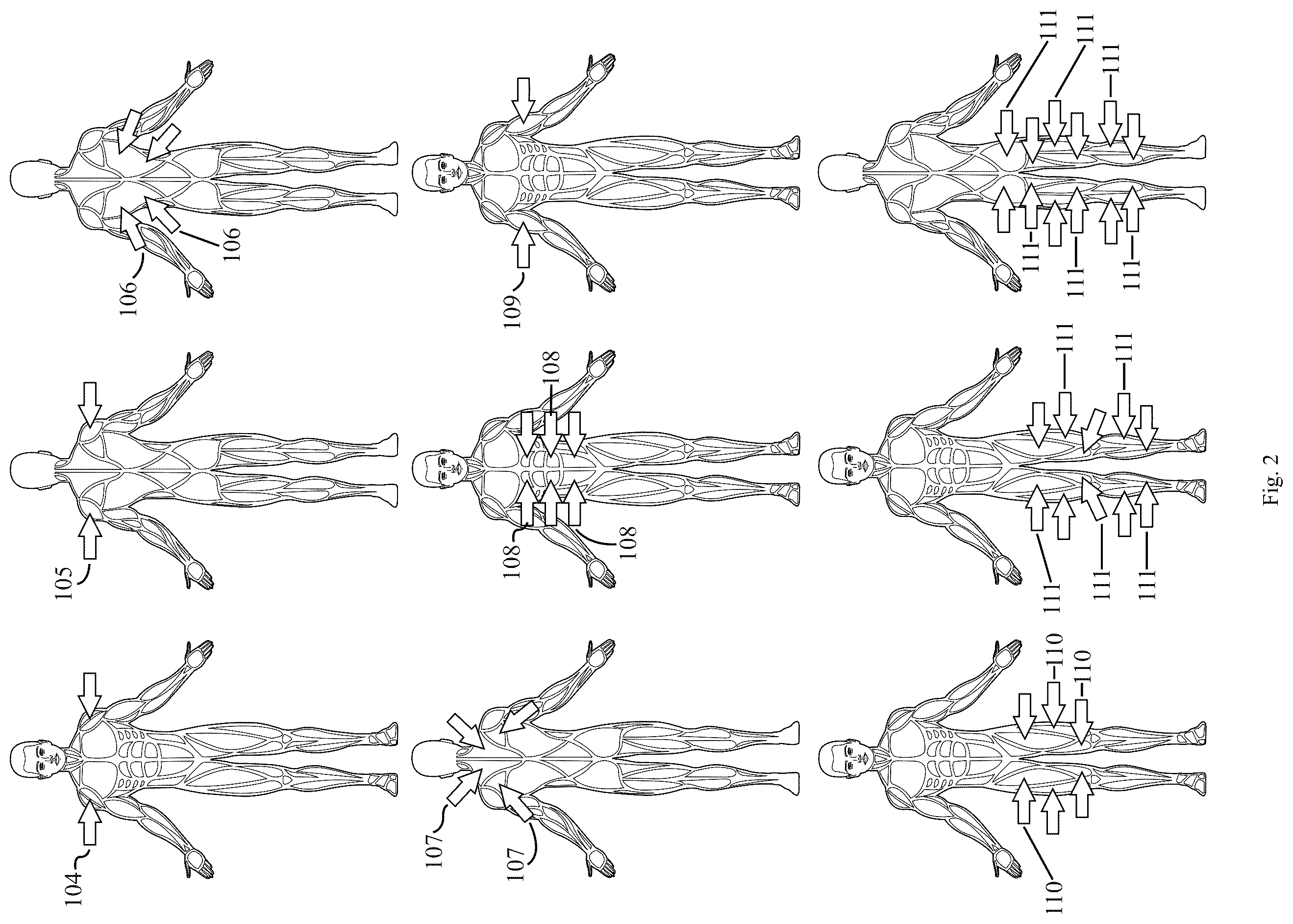 Patent US12496487 Figure 2 – Plate squeeze chest press