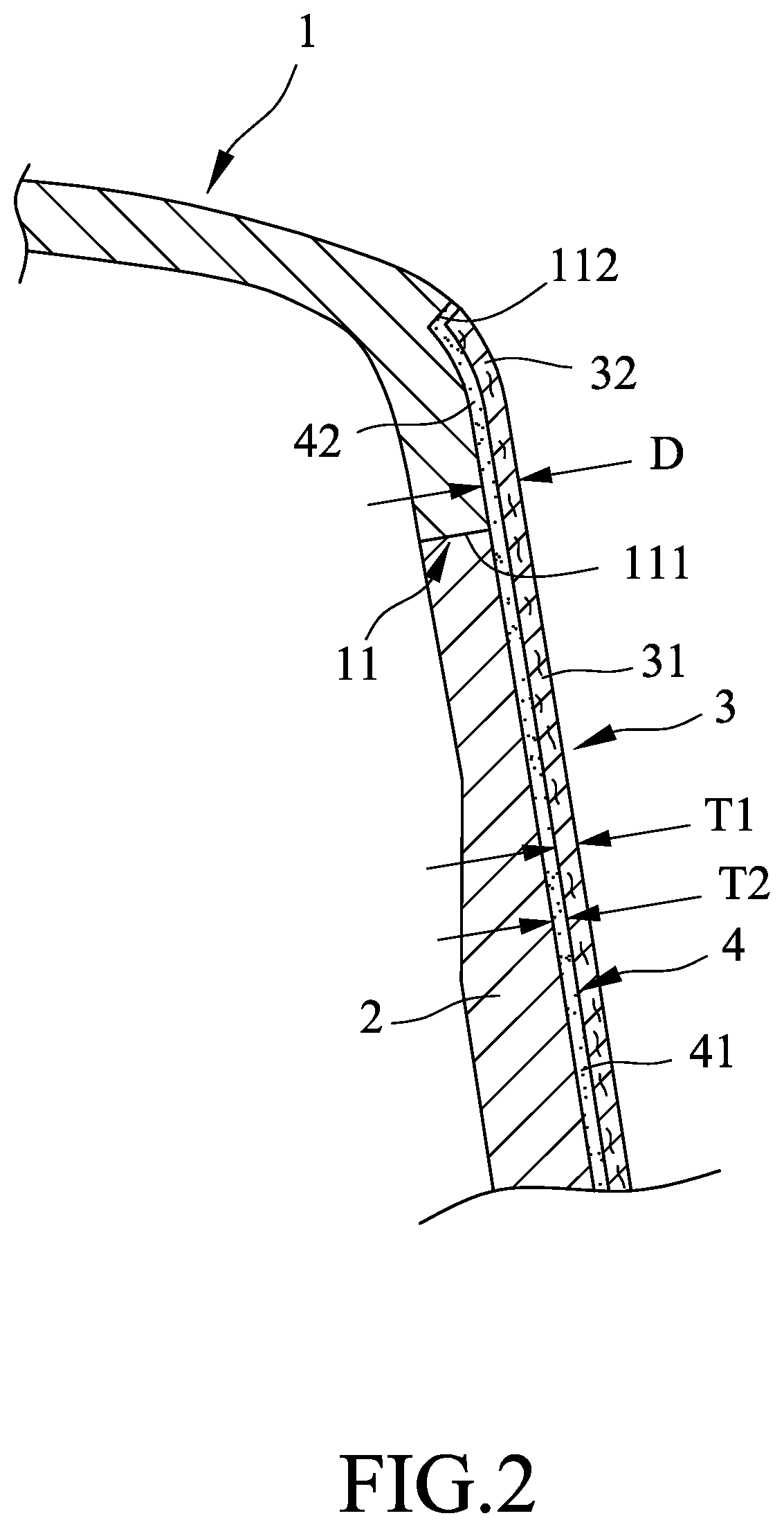 Patent US12496499 Figure 2 – Golf club head