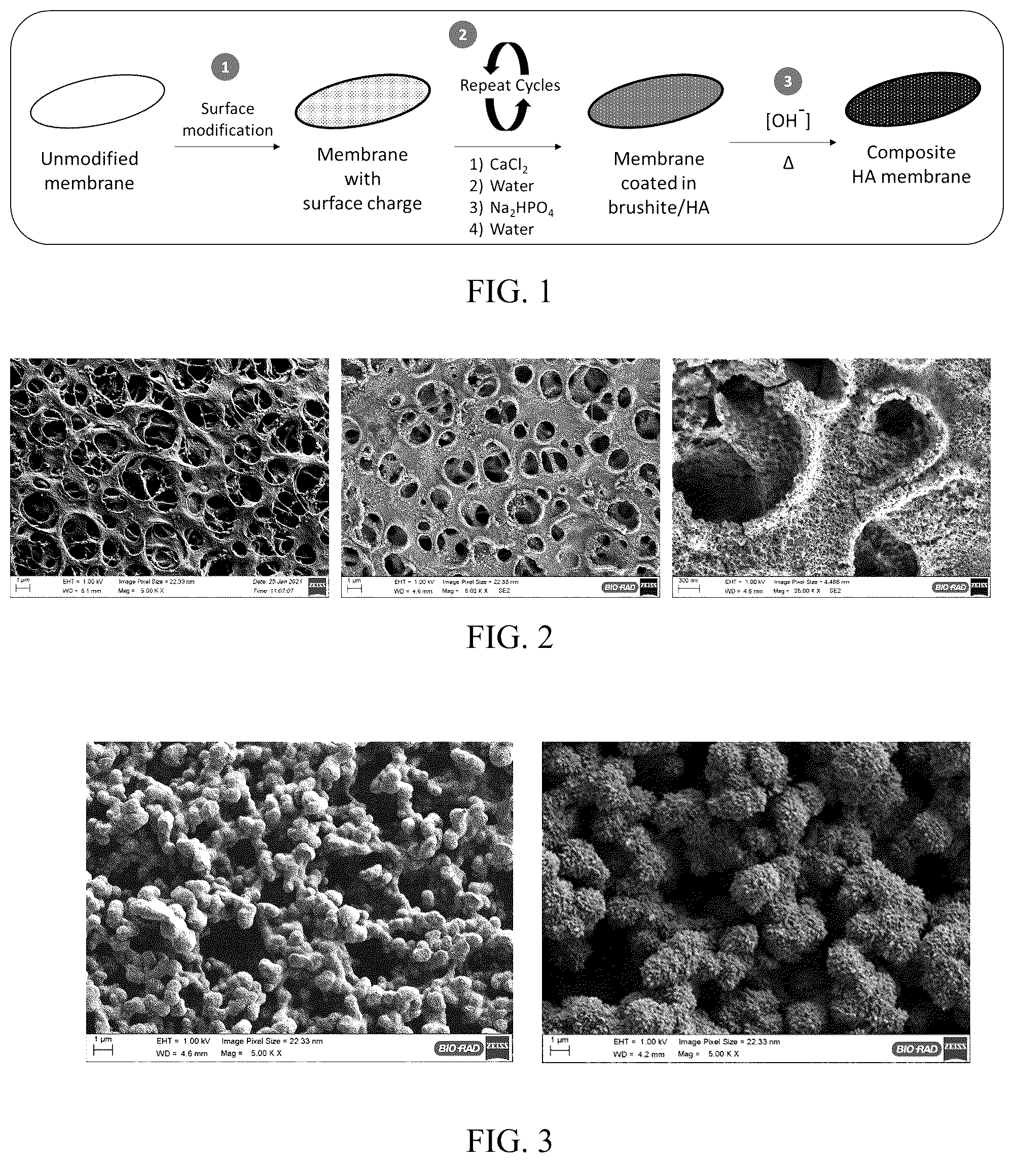 Patent US12496567 — Polymer-hydroxyapatite composite membranes — Figure 1