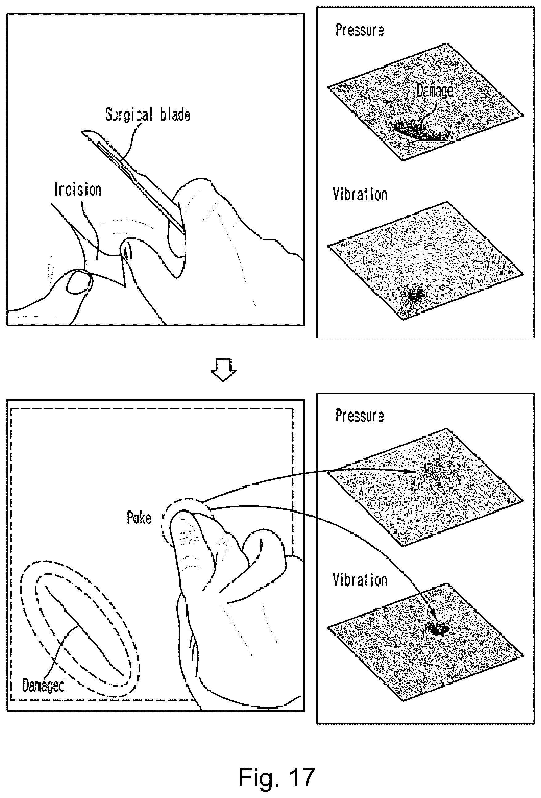 Patent US12496730 Figure 11 – Biomimetic tactile sensor, robotic skin comprising the same and preparation method therefor