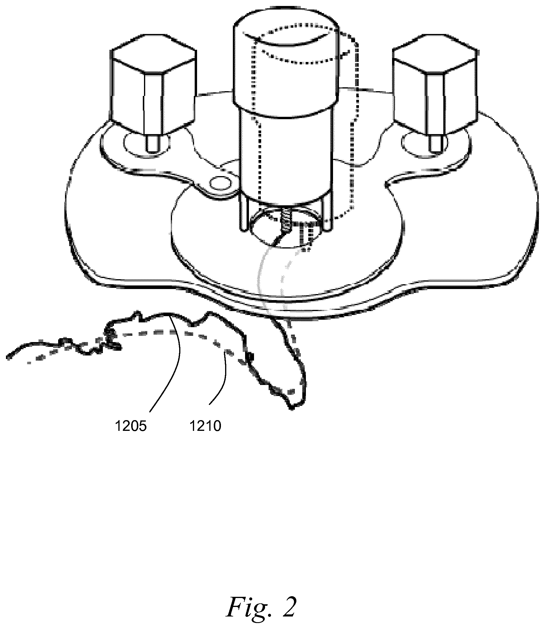 Patent US12496739 Figure 2 – Systems and methods for performing a task on a material, or locating the position of a device relative to the surface of the material