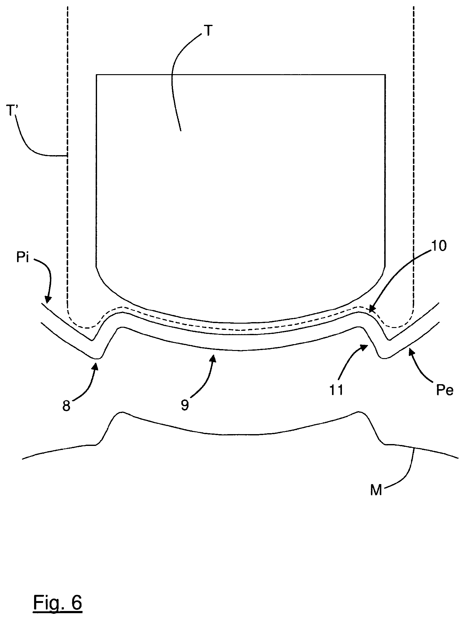 Patent US12496762 Figure 6 – Container preform made of plastic