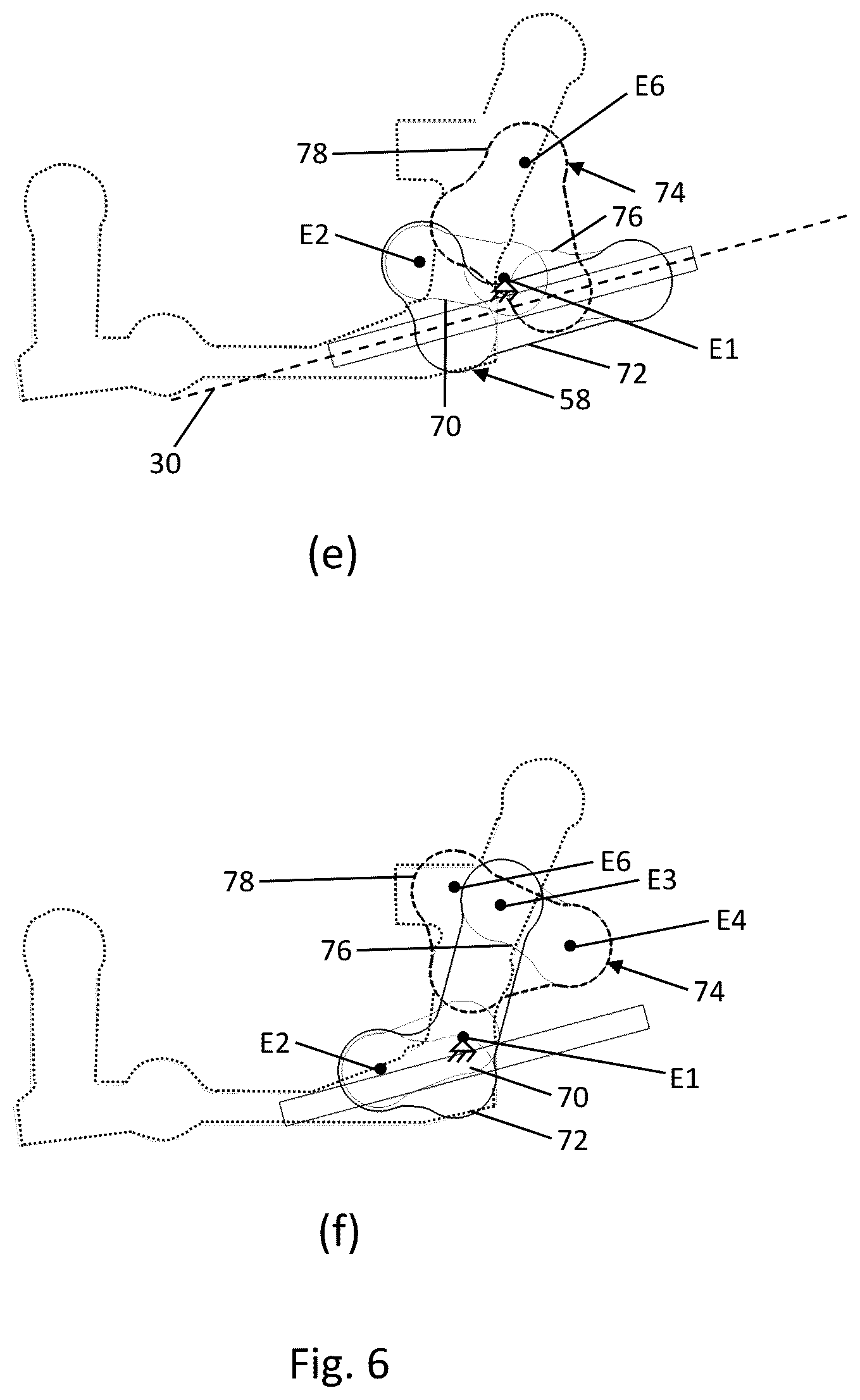 Patent US12496985 Figure 10 – Roof module for forming a vehicle roof