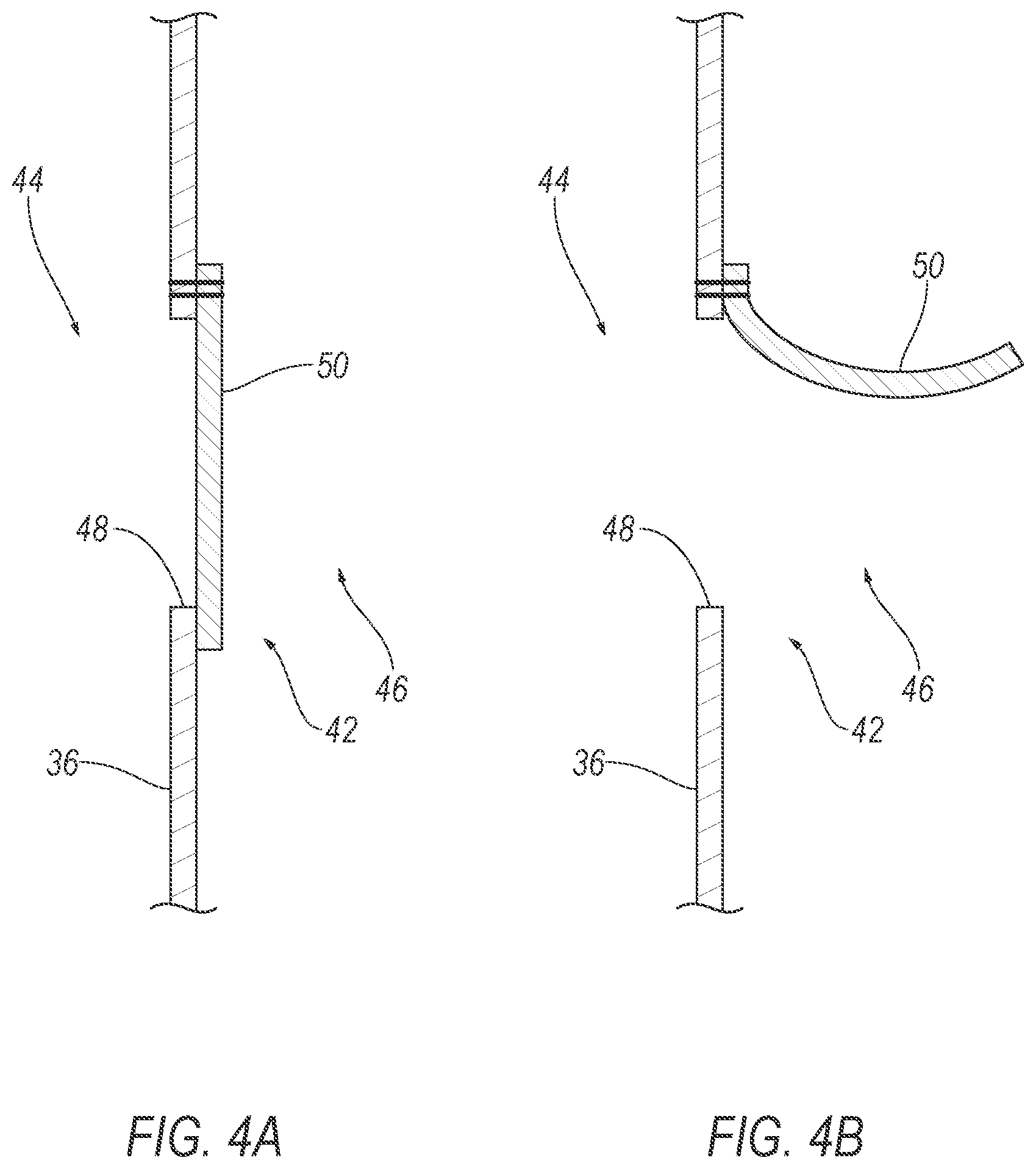 Patent US12496995 Figure 4 – Vehicle airbag with elastic vent assembly