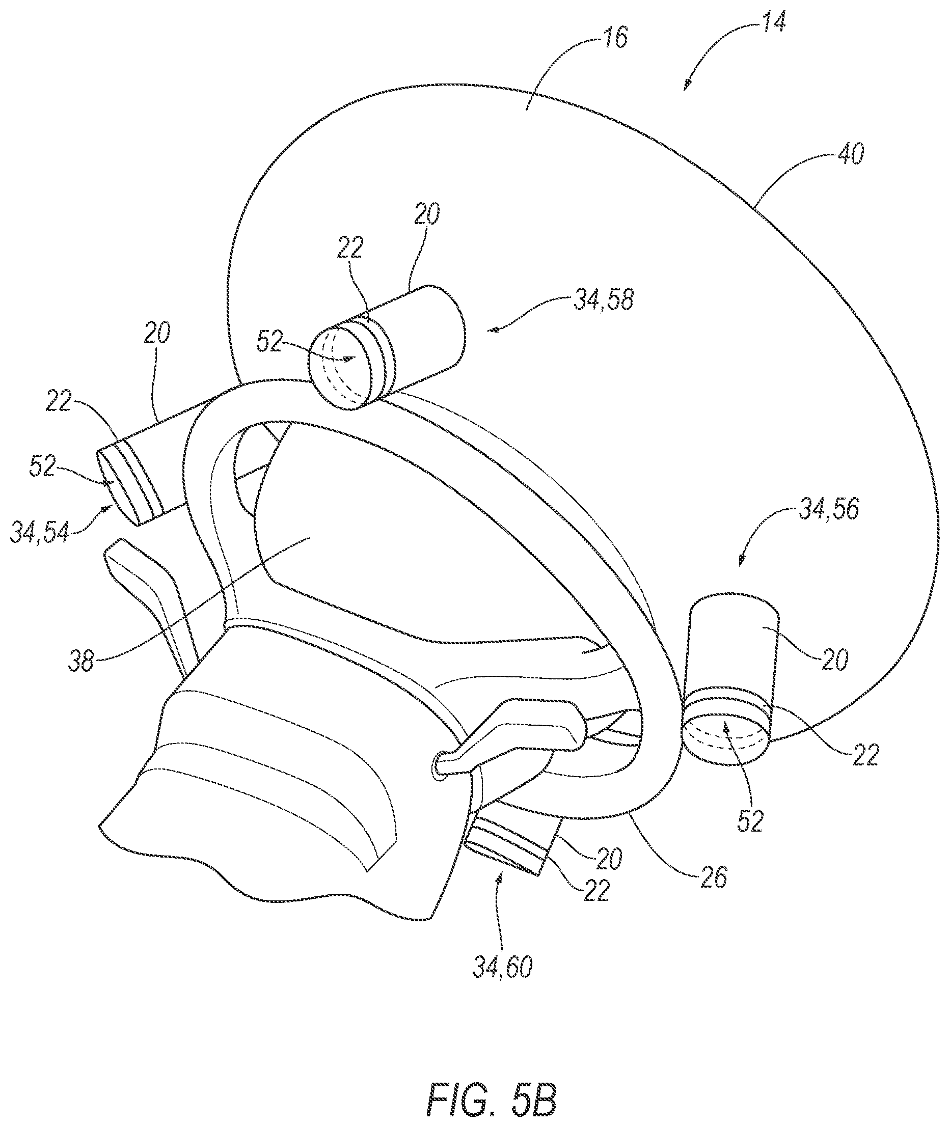Patent US12496995 Figure 6 – Vehicle airbag with elastic vent assembly