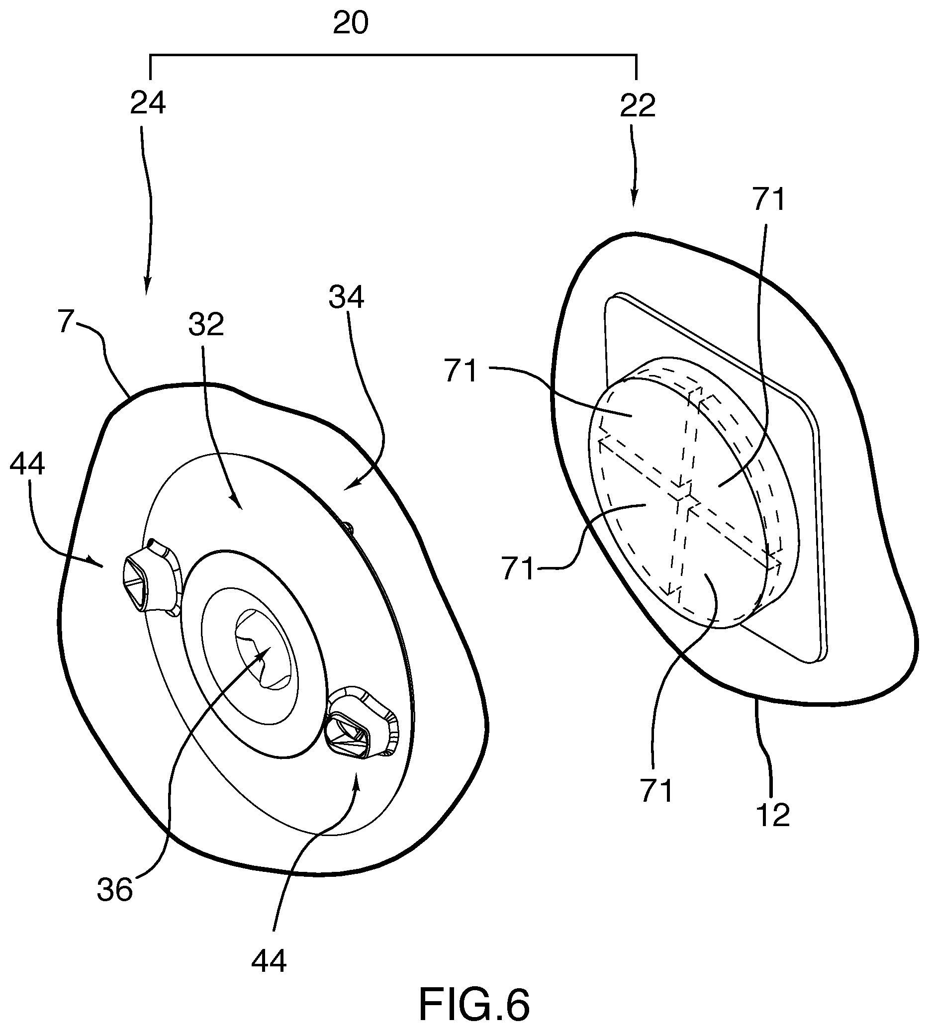 Patent US12497971 Figure 5 – System for adapting foot spas for use with disposable pumps