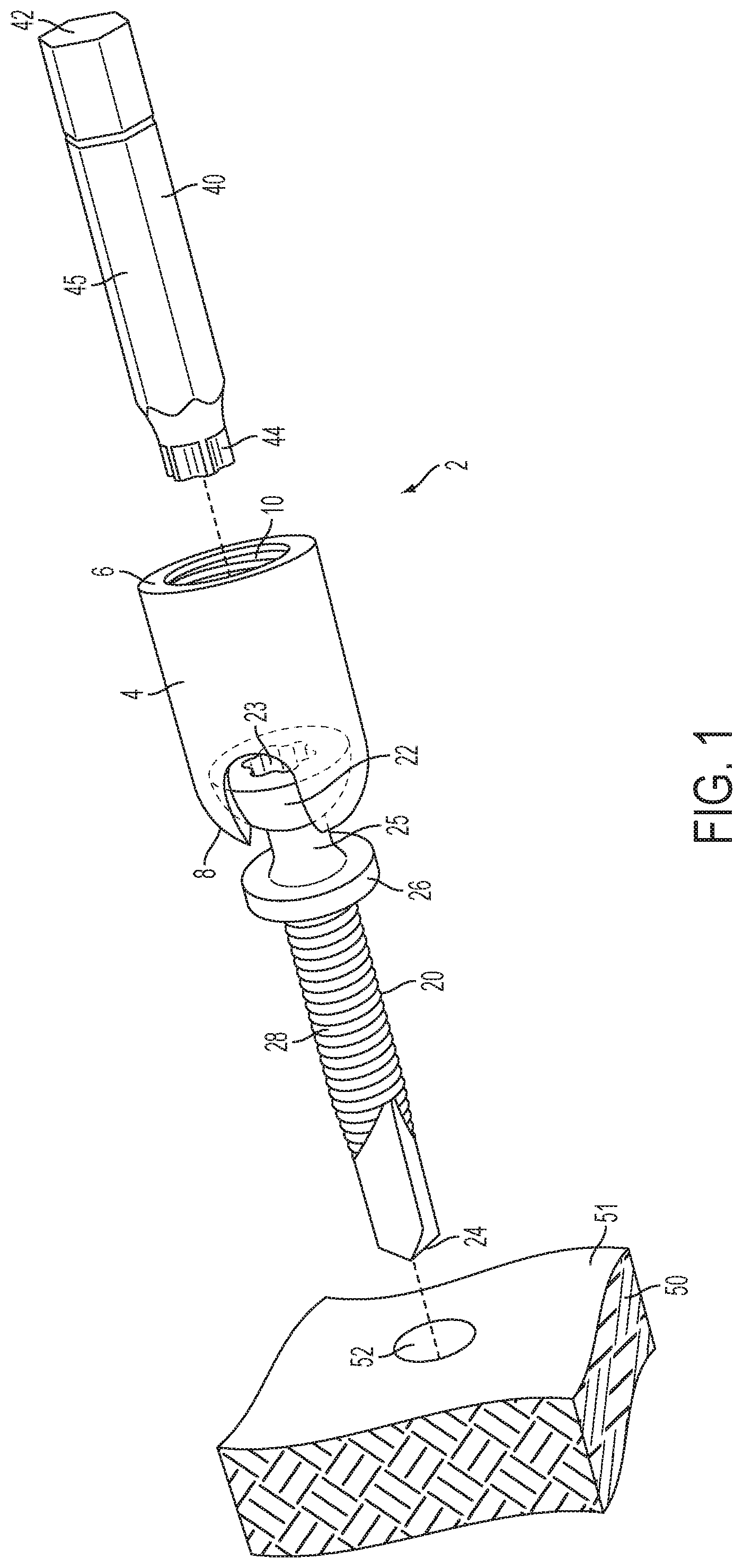 Patent US12504039 Figure 1 – Swivel hanger