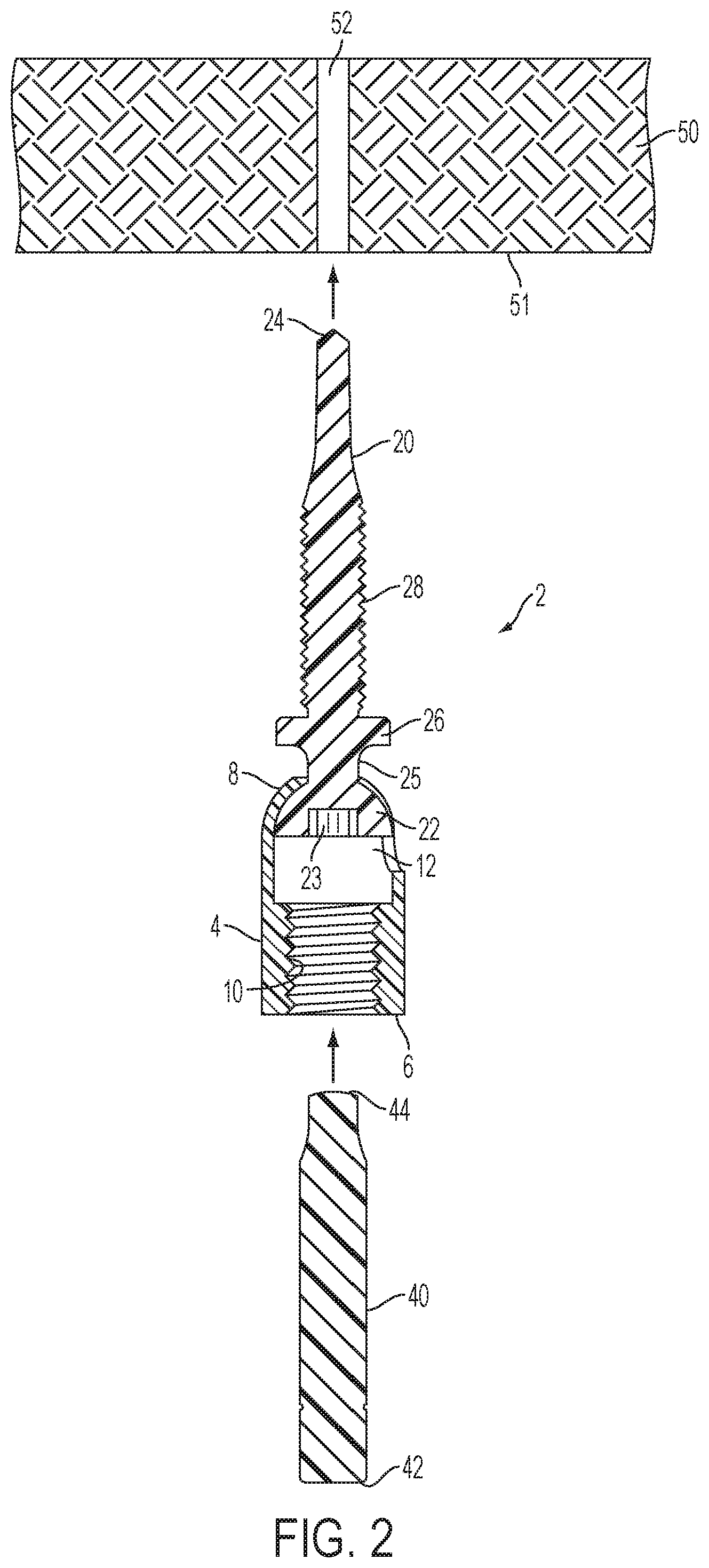 Patent US12504039 Figure 2 – Swivel hanger