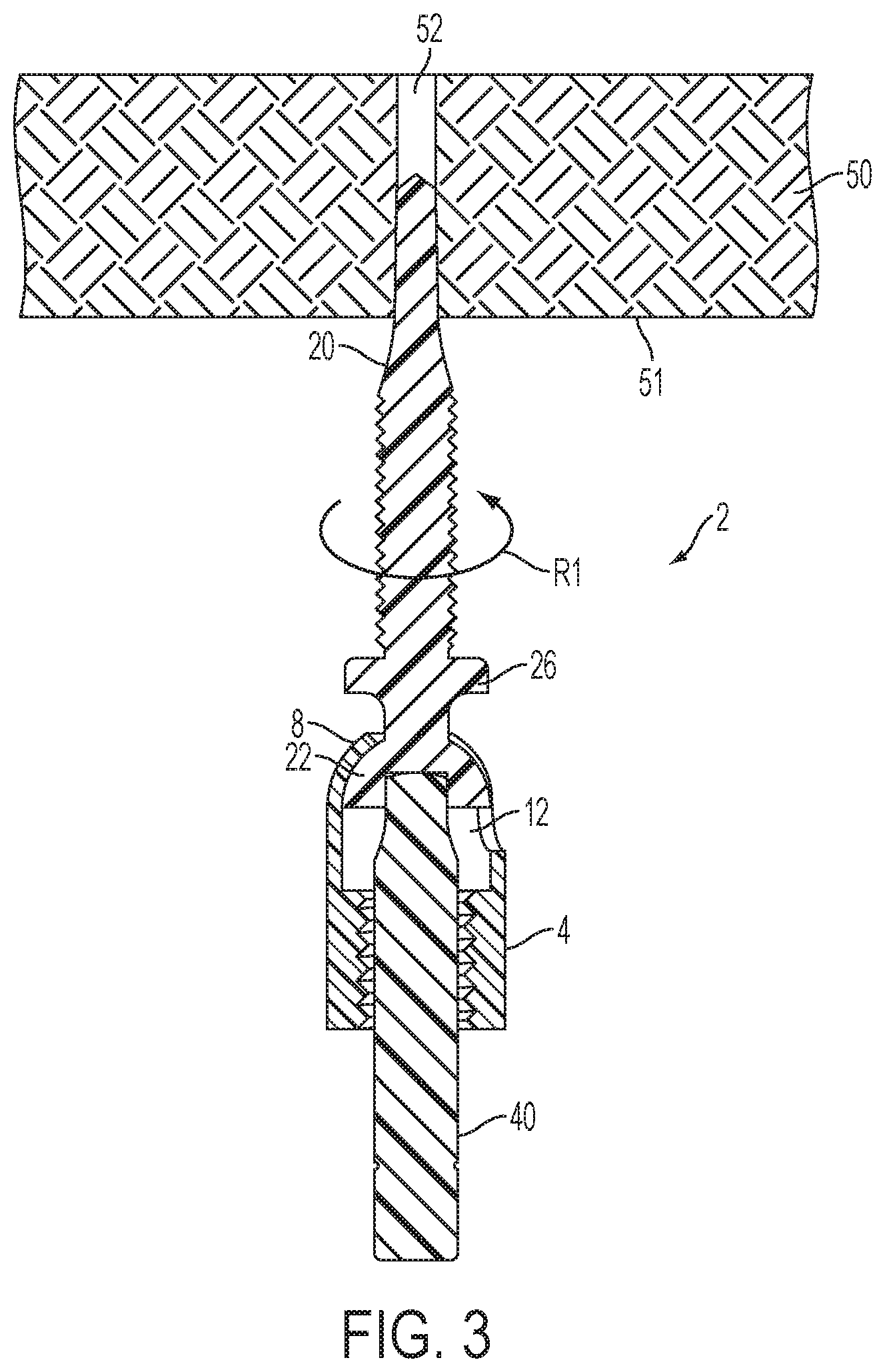 Patent US12504039 Figure 3 – Swivel hanger