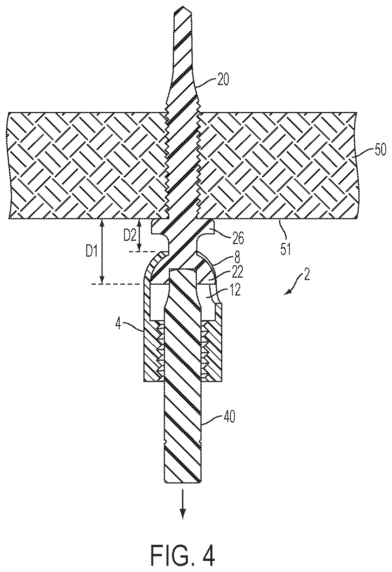 Patent US12504039 Figure 4 – Swivel hanger
