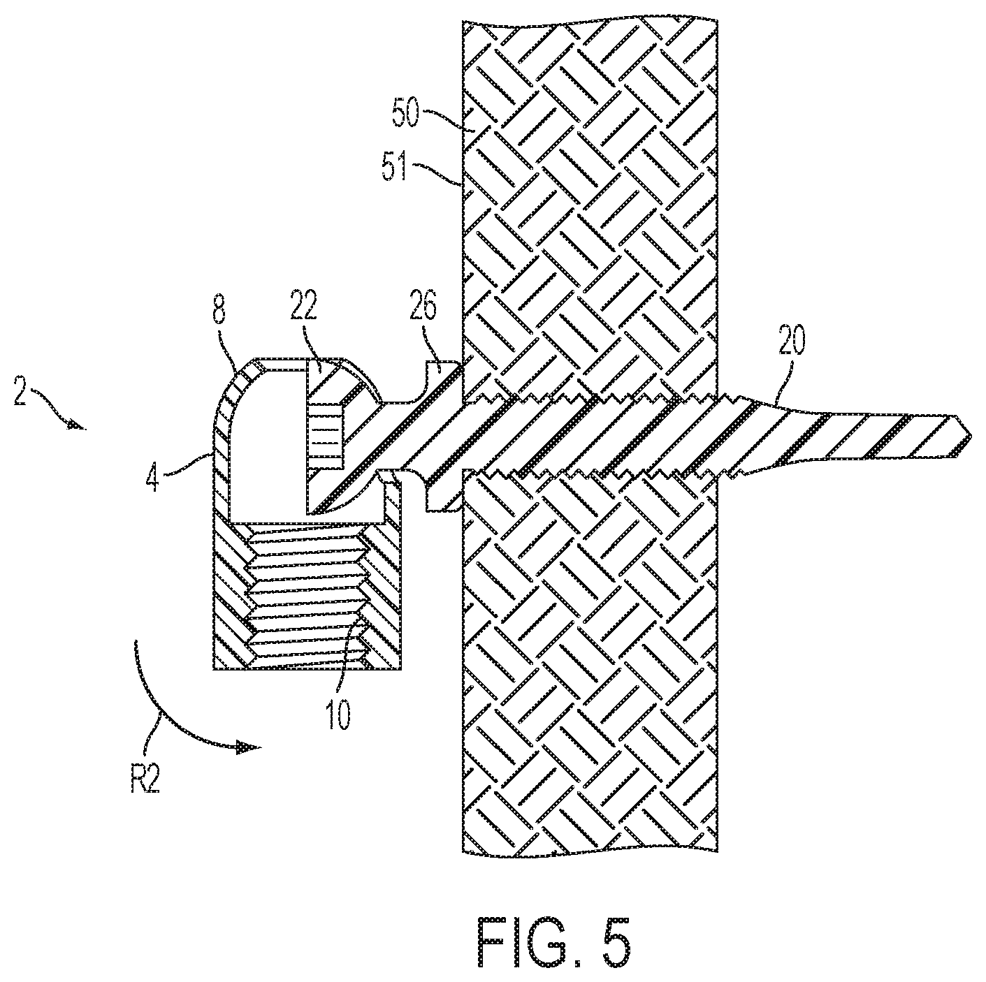 Patent US12504039 Figure 5 – Swivel hanger