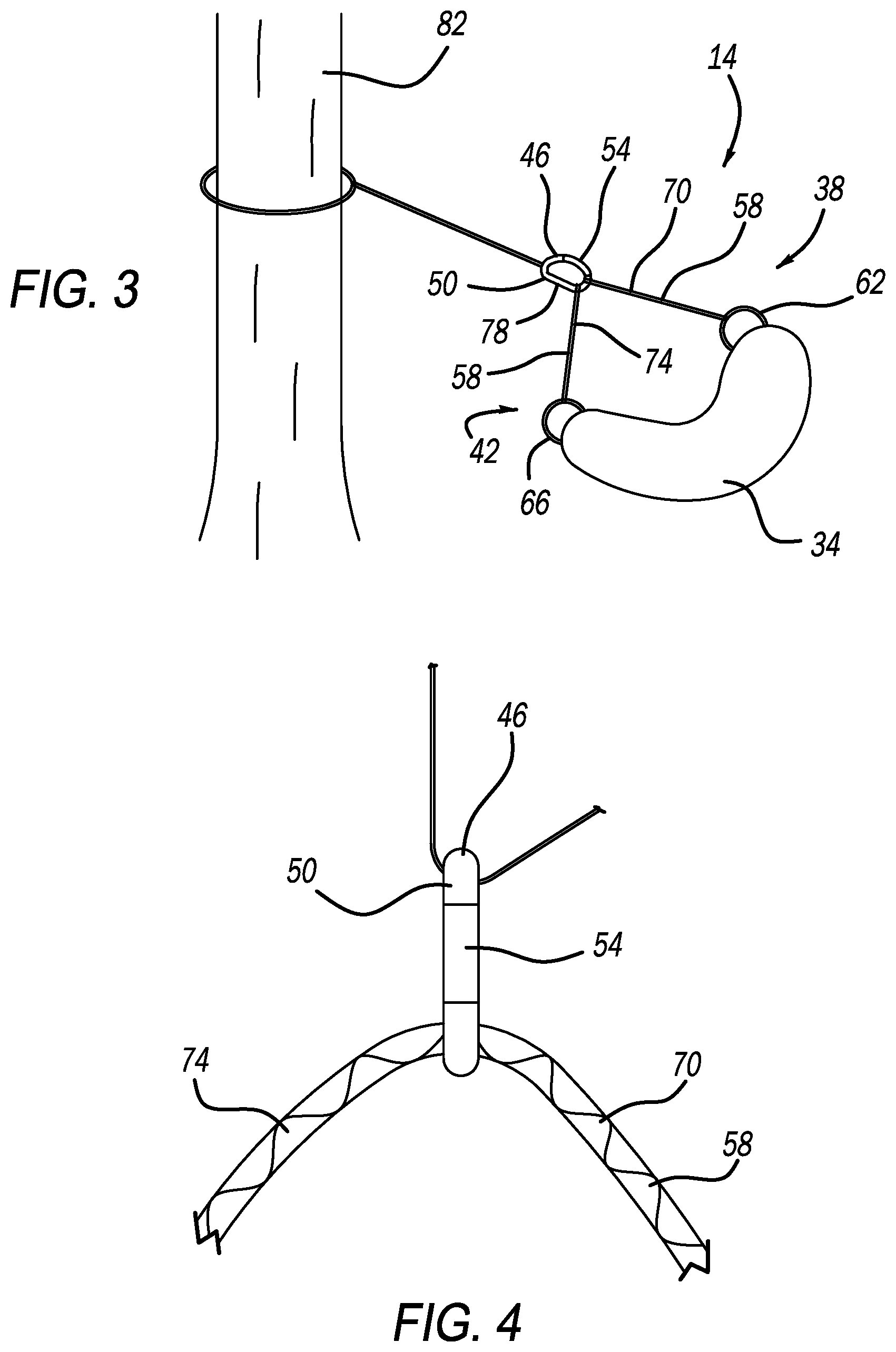 Patent US12504116 Figure 2 – Accessory support for hunting saddle