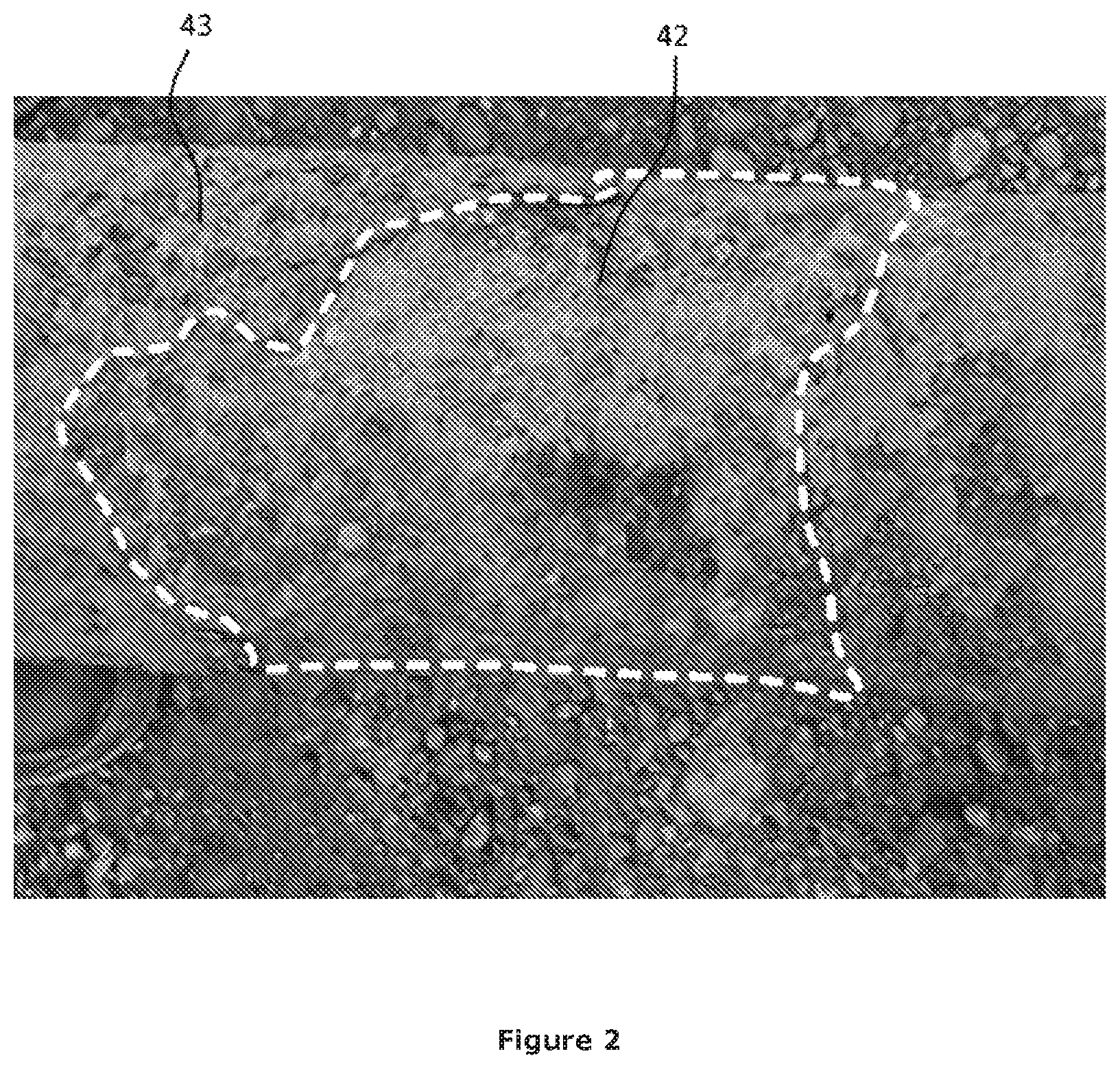 Patent US12504267 Figure 2 – Method of and apparatus for determining variations in wall thickness in ferromagnetic tubes