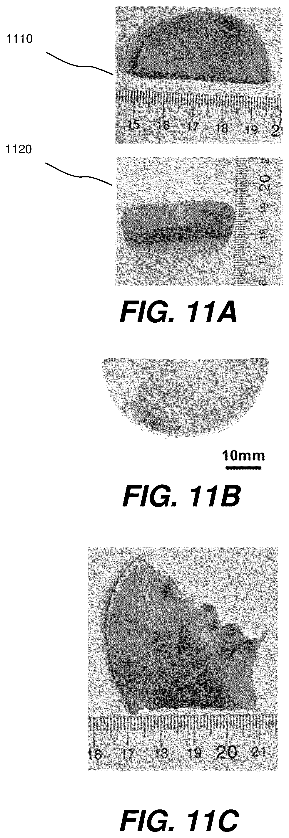 Patent US12504363 Figure 11 – Three-dimensional contoured scanning photoacoustic imaging and virtual staining