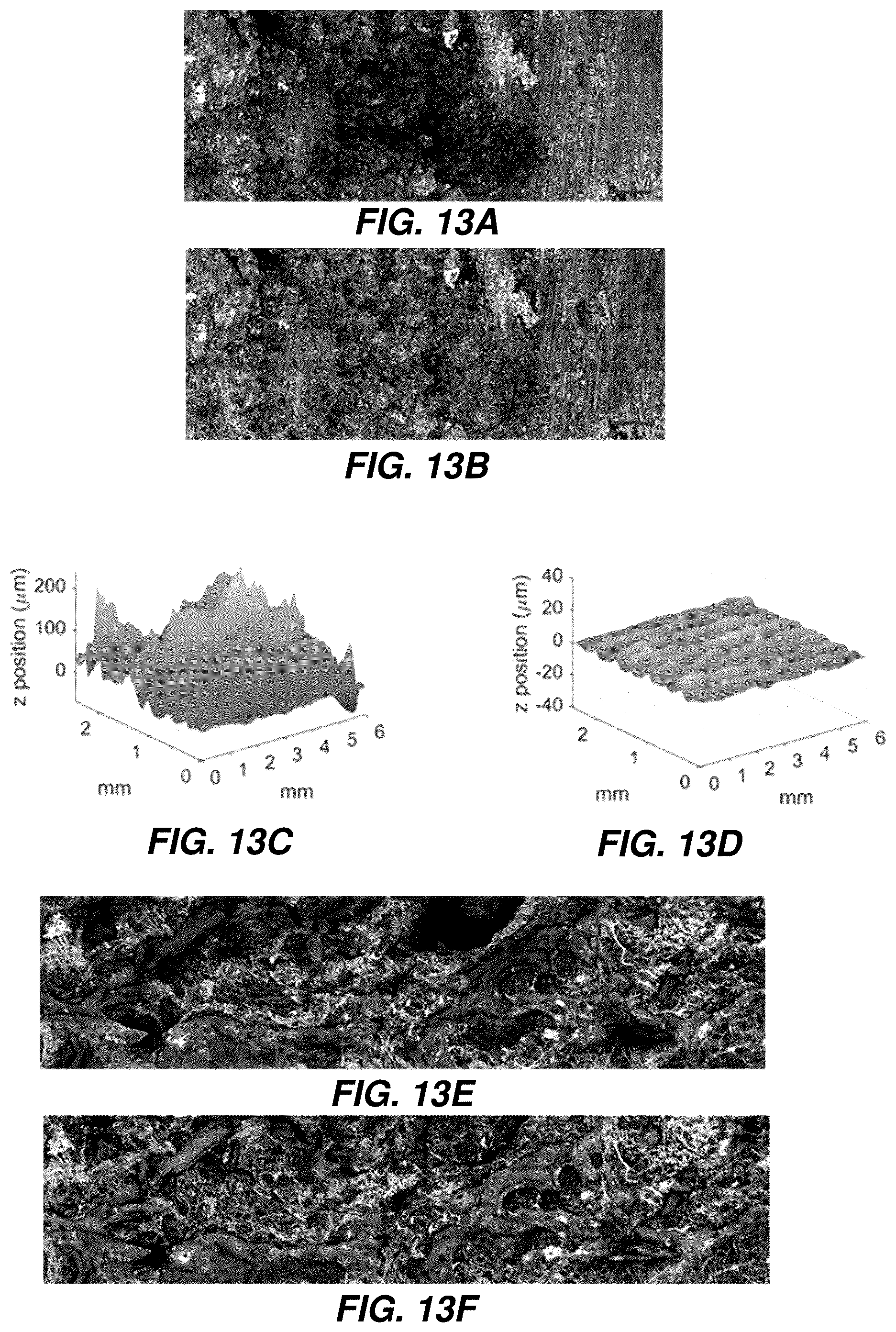 Patent US12504363 Figure 13 – Three-dimensional contoured scanning photoacoustic imaging and virtual staining