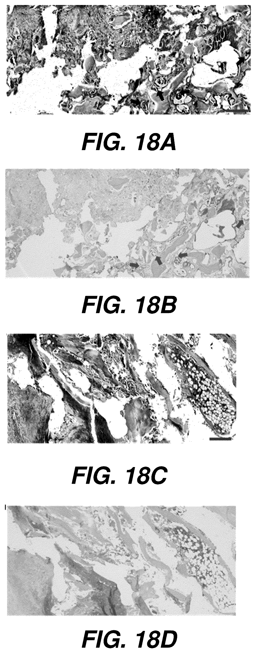 Patent US12504363 Figure 18 – Three-dimensional contoured scanning photoacoustic imaging and virtual staining