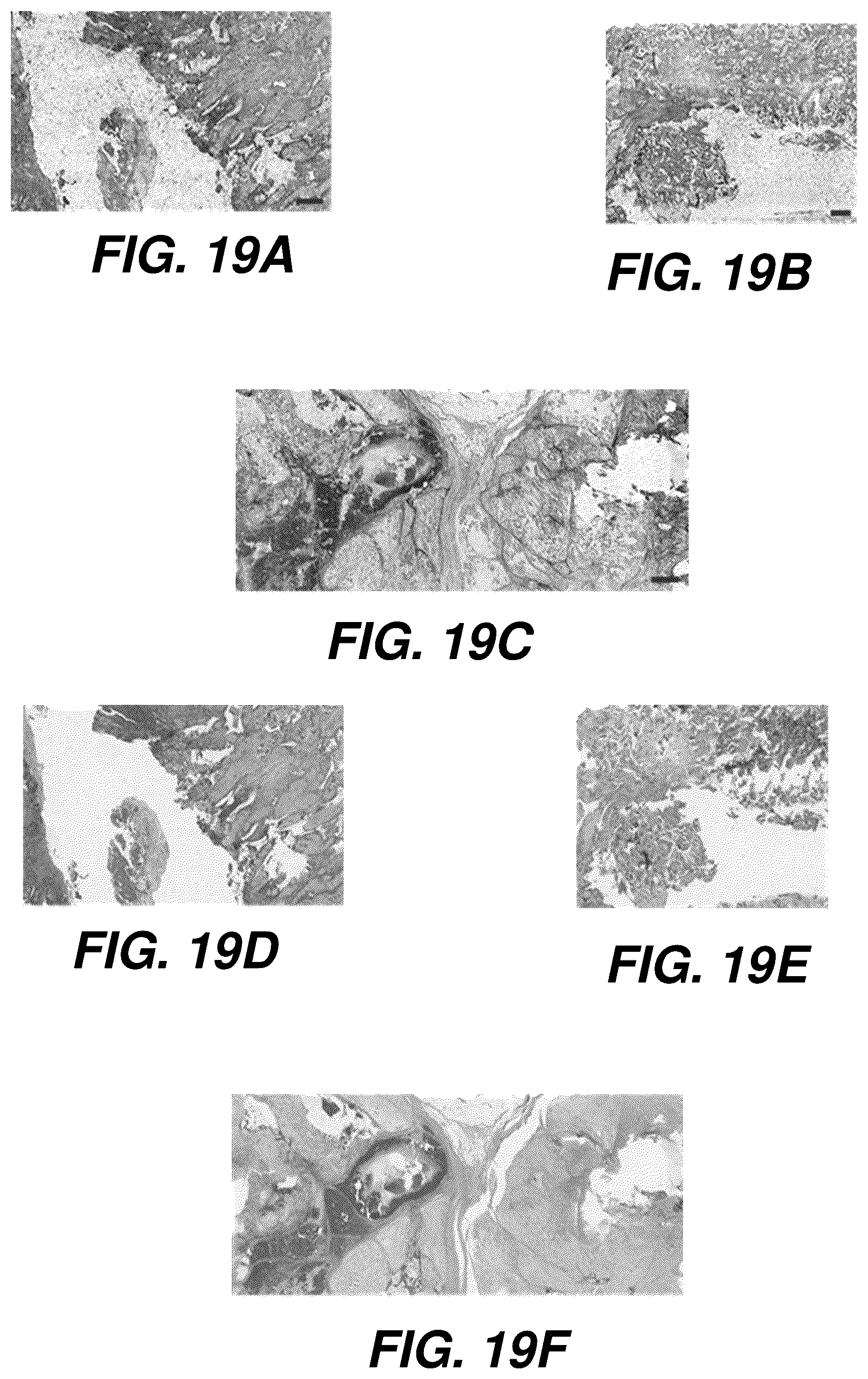 Patent US12504363 Figure 19 – Three-dimensional contoured scanning photoacoustic imaging and virtual staining