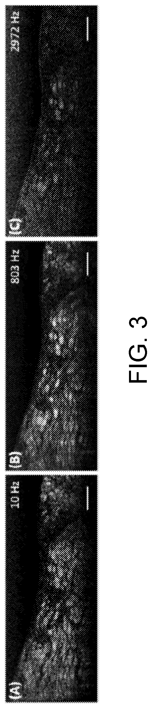 Patent US12504371 Figure 3 – System and method of dynamic micro-optical coherence tomography for mapping cellular functions