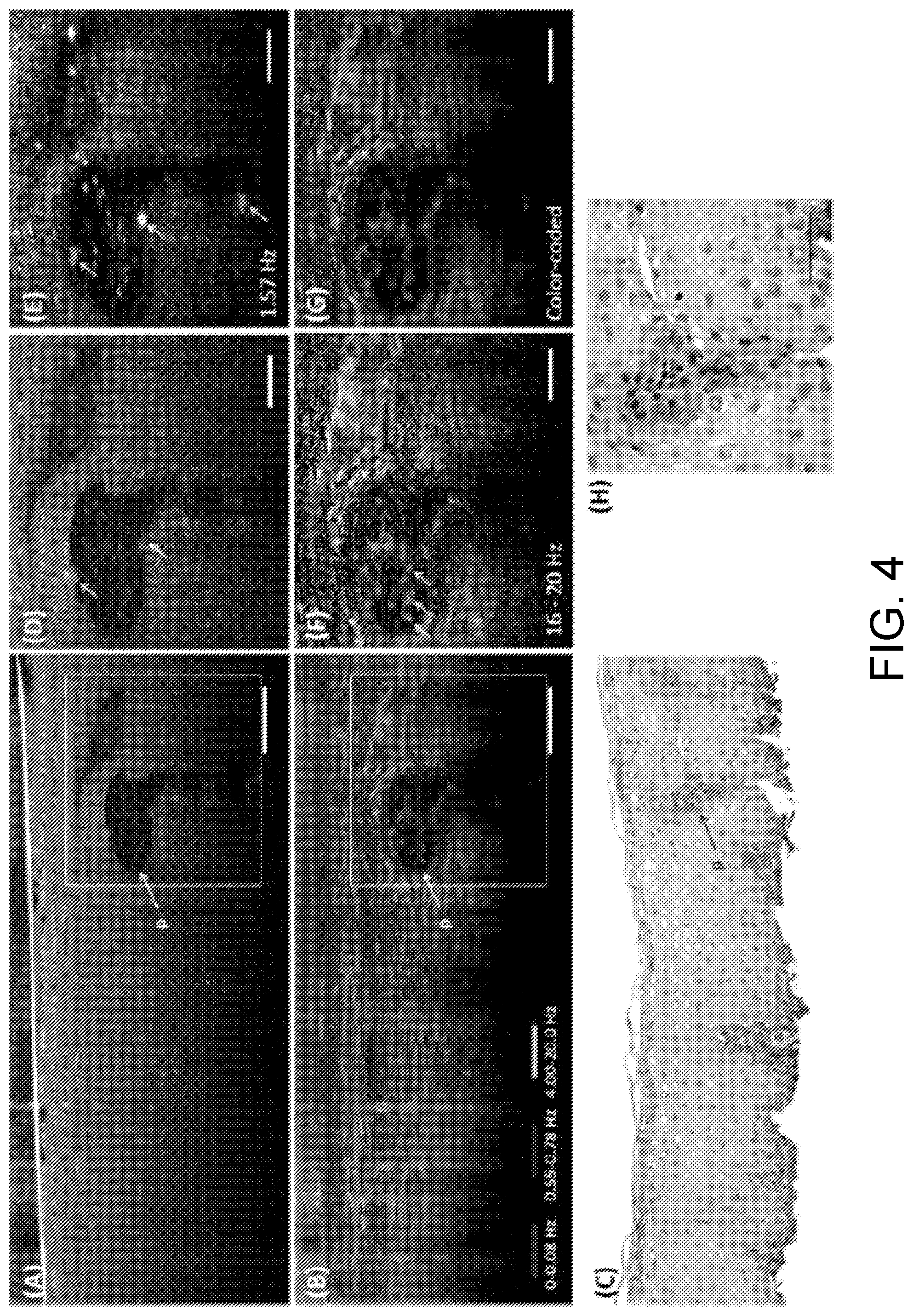 Patent US12504371 Figure 4 – System and method of dynamic micro-optical coherence tomography for mapping cellular functions