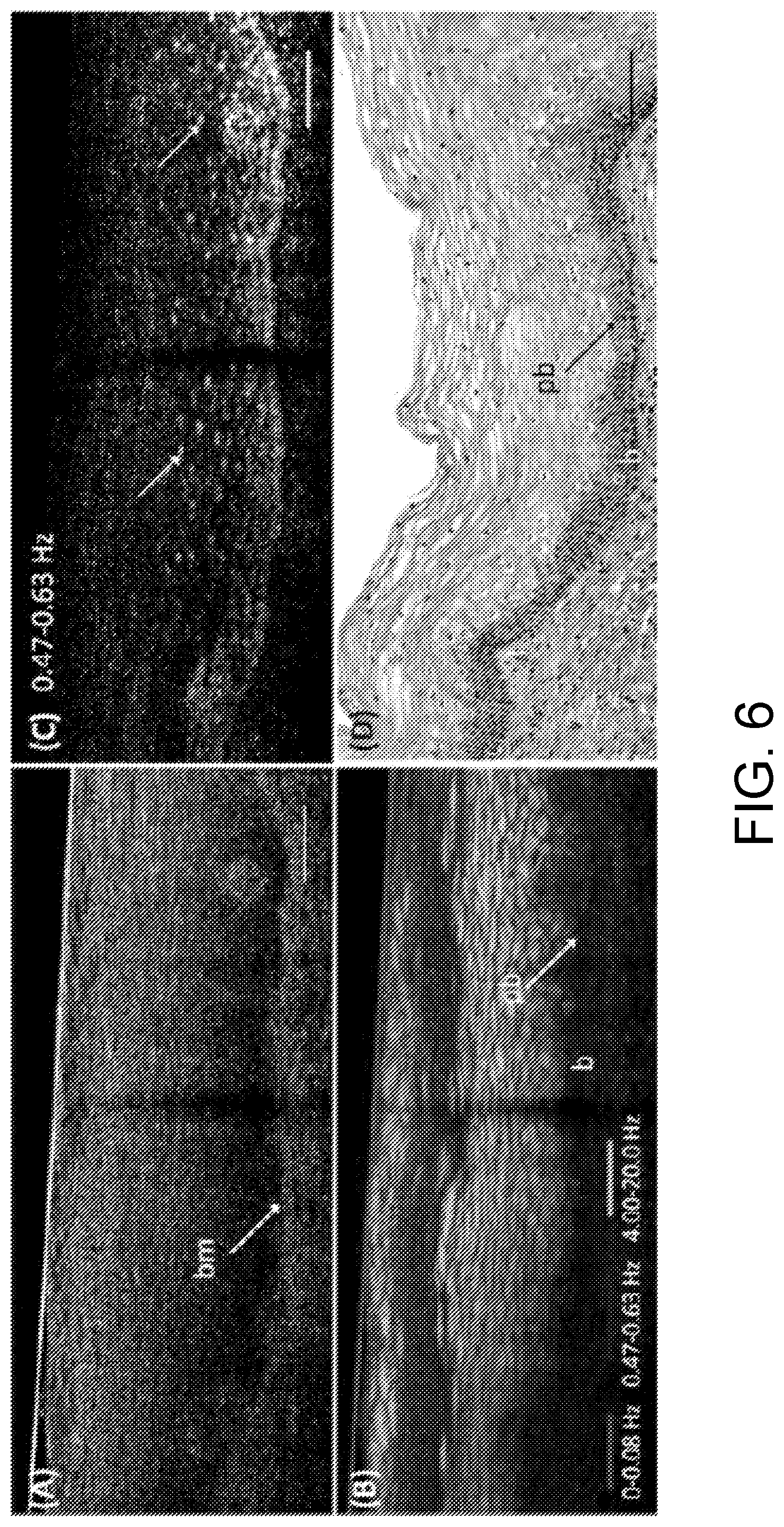 Patent US12504371 Figure 6 – System and method of dynamic micro-optical coherence tomography for mapping cellular functions