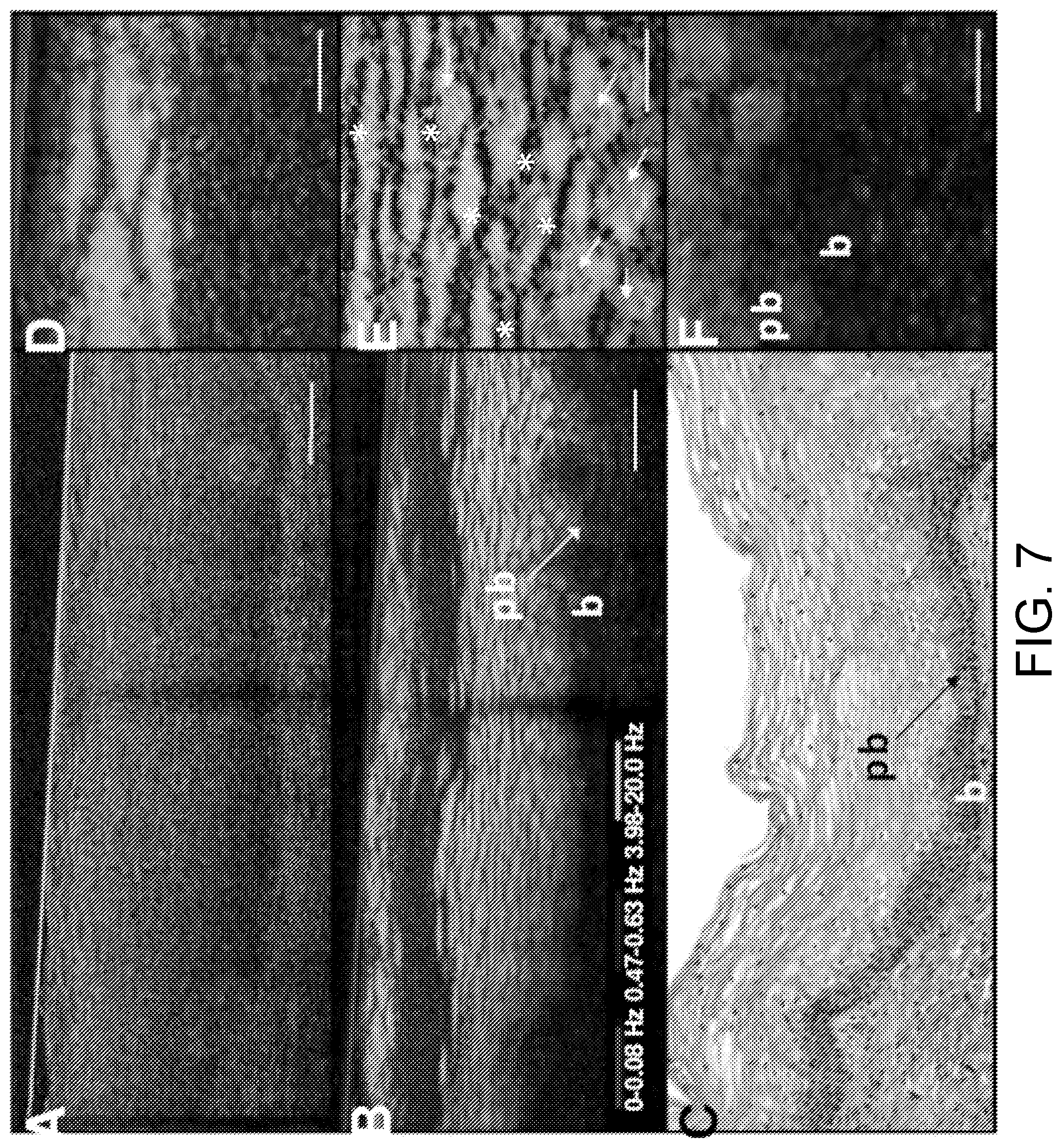 Patent US12504371 Figure 7 – System and method of dynamic micro-optical coherence tomography for mapping cellular functions