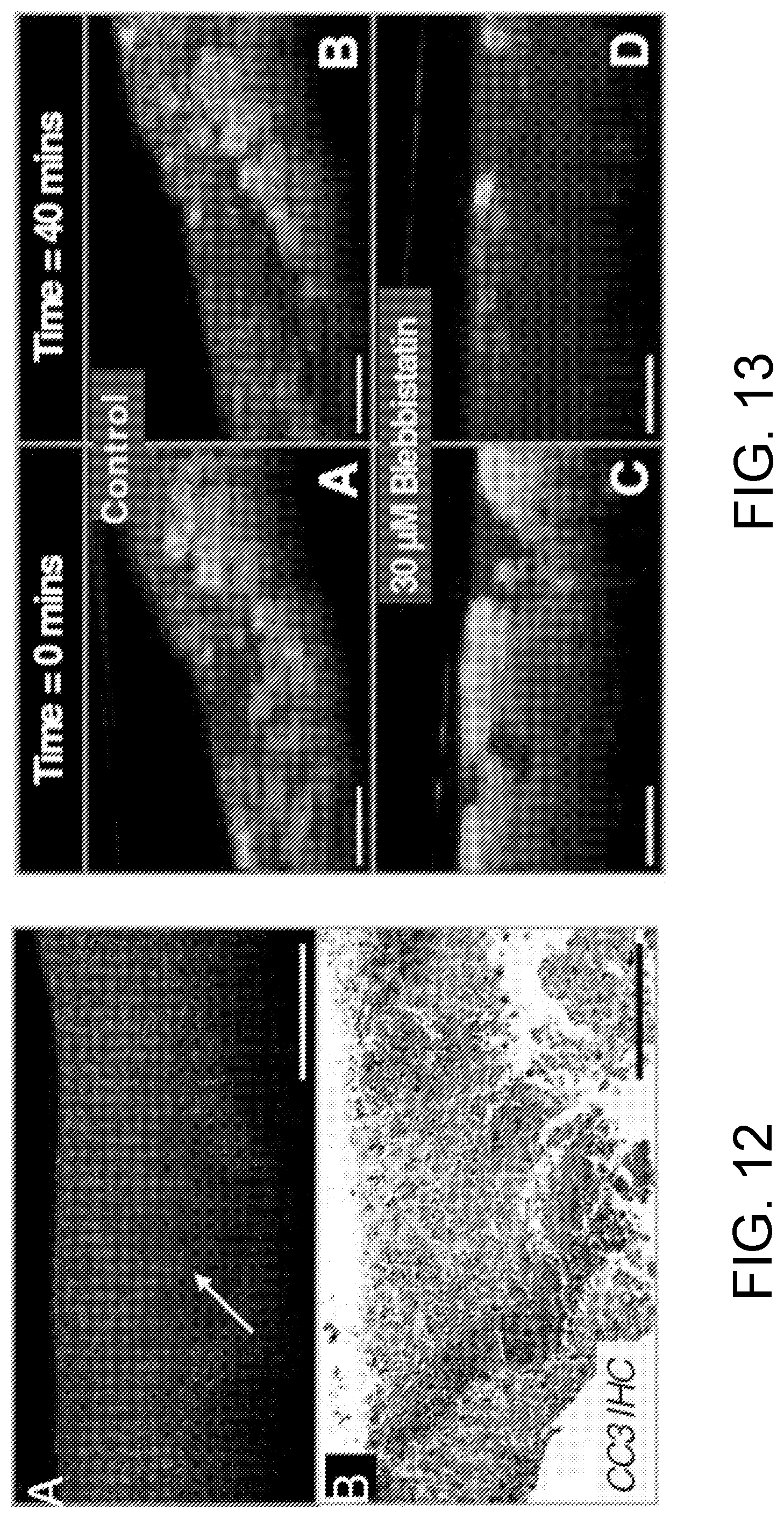 Patent US12504371 Figure 11 – System and method of dynamic micro-optical coherence tomography for mapping cellular functions