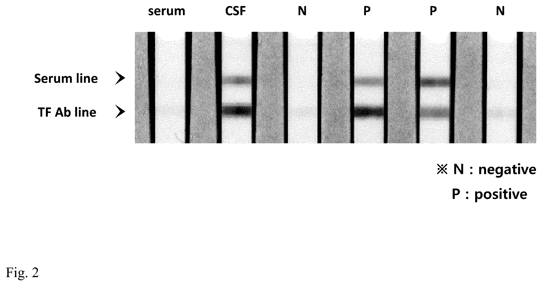 Patent US12504427 Figure 2 – Assay for rapid detection of cerebrospinal fluid leaks