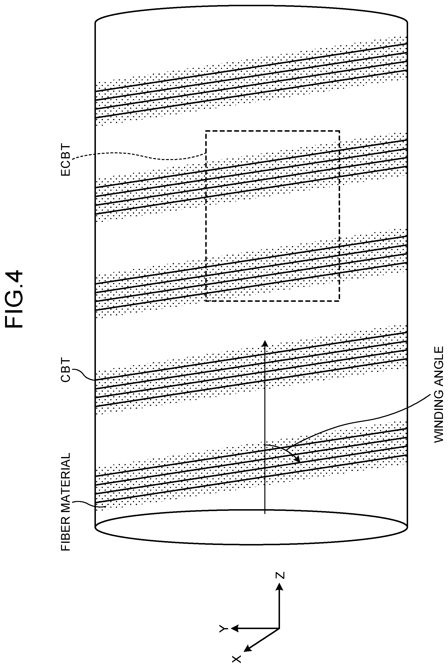 Patent US12504488 Figure 4 – Sound-proofing tube for magnetic resonance imaging apparatus, magnetic resonance imaging apparatus, and manufacturing method of sound-proofing tube for magnetic resonance imaging apparatus