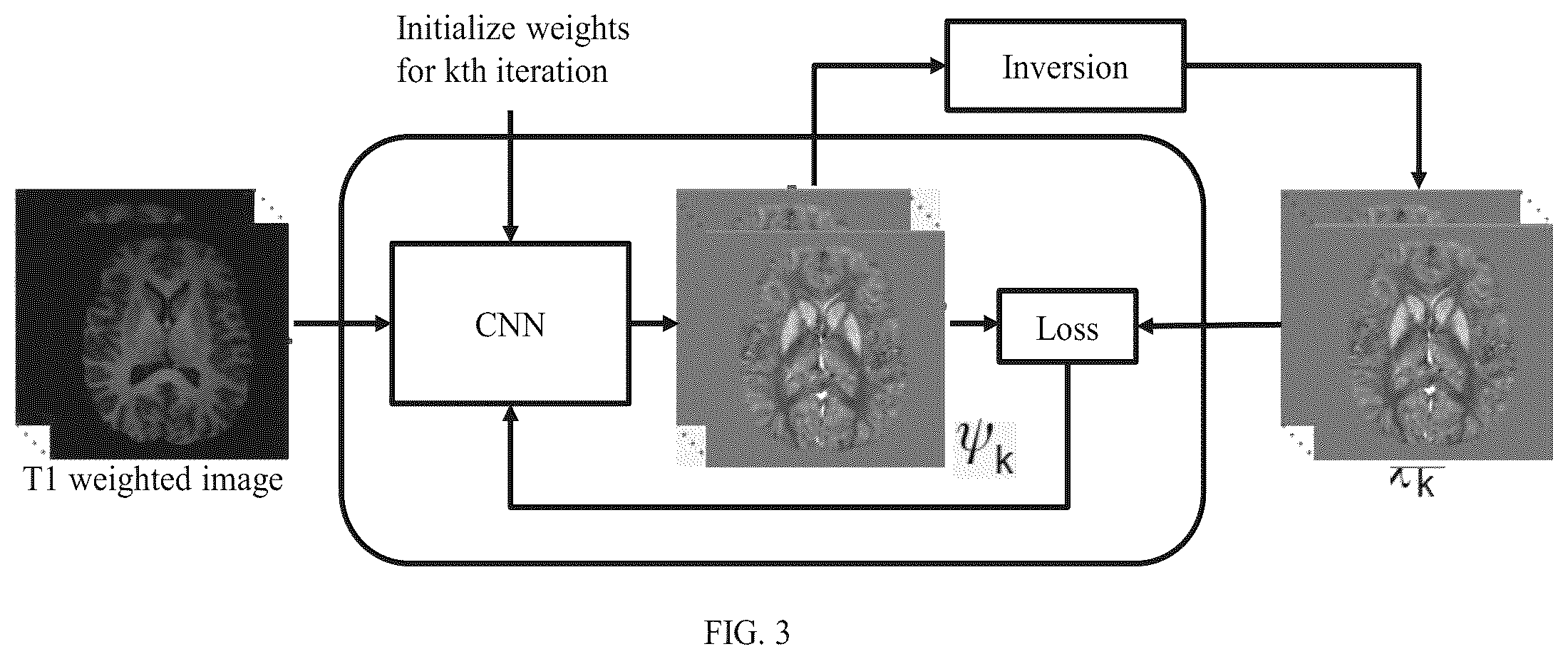 Patent US12504493 Figure 4 – Method and system for quantitative susceptibility mapping reconstruction in low-field magnetic resonance imaging (MRI) system