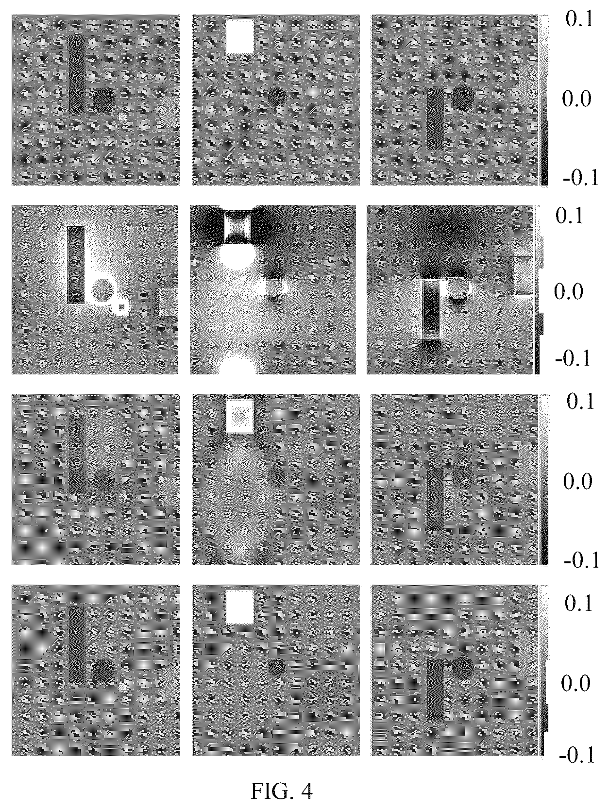 Patent US12504493 Figure 5 – Method and system for quantitative susceptibility mapping reconstruction in low-field magnetic resonance imaging (MRI) system