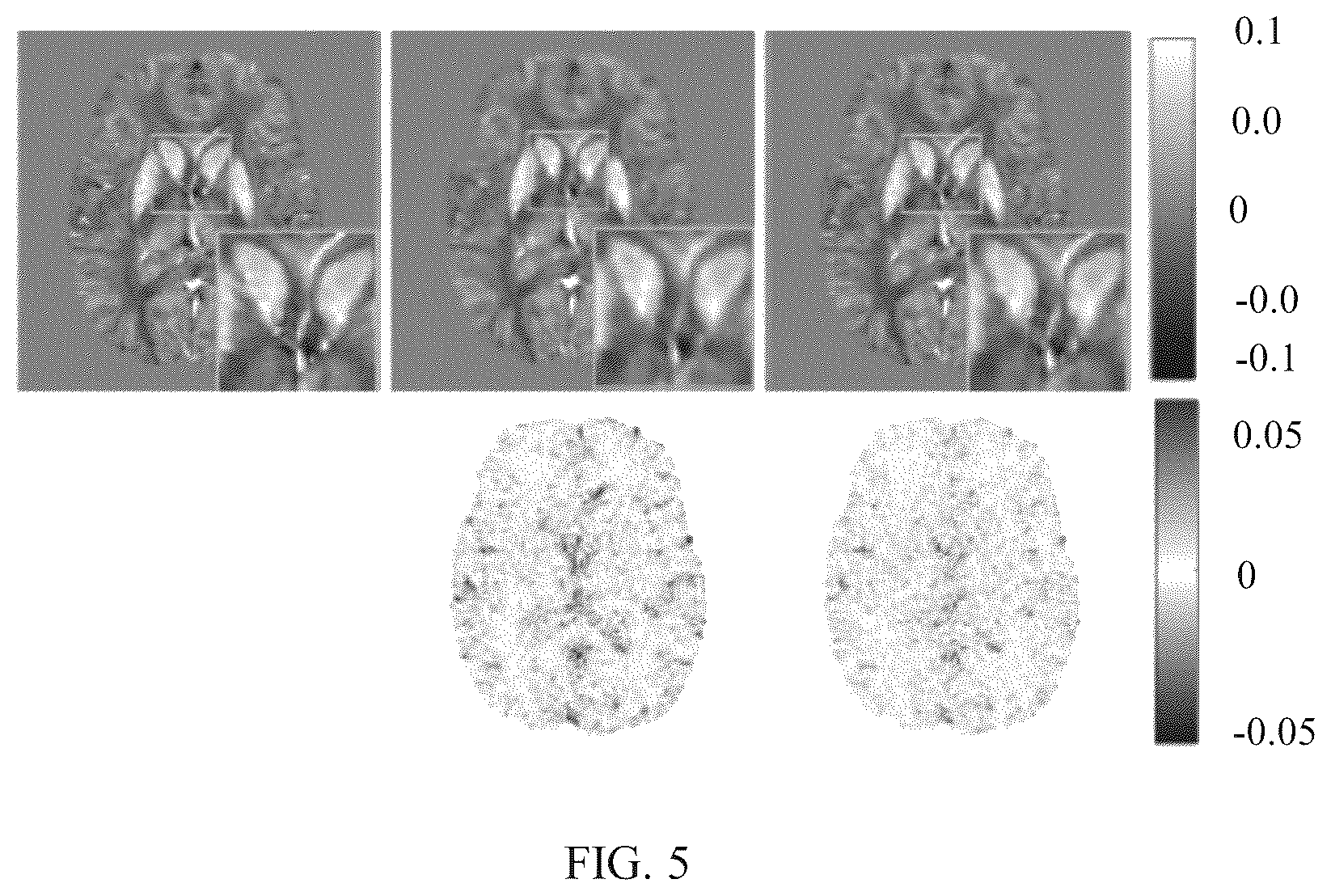 Patent US12504493 Figure 6 – Method and system for quantitative susceptibility mapping reconstruction in low-field magnetic resonance imaging (MRI) system