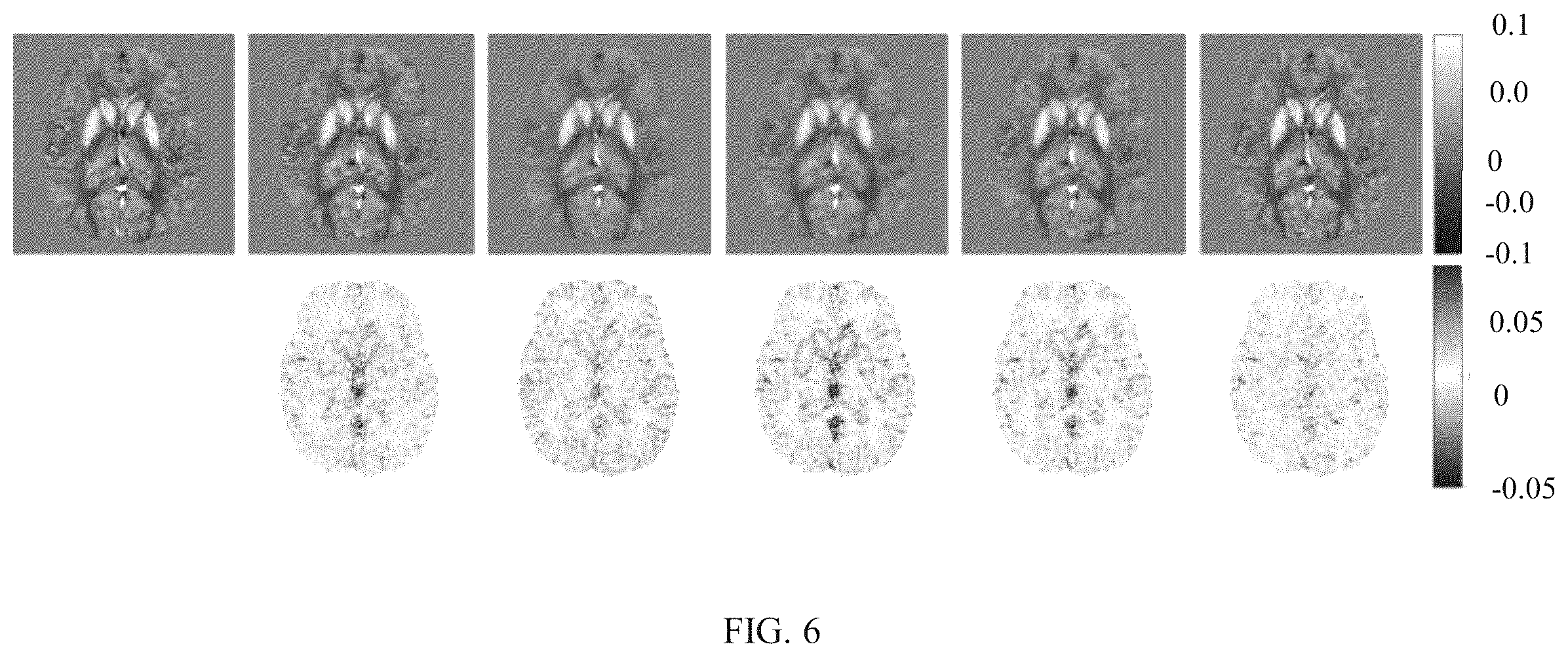 Patent US12504493 Figure 7 – Method and system for quantitative susceptibility mapping reconstruction in low-field magnetic resonance imaging (MRI) system