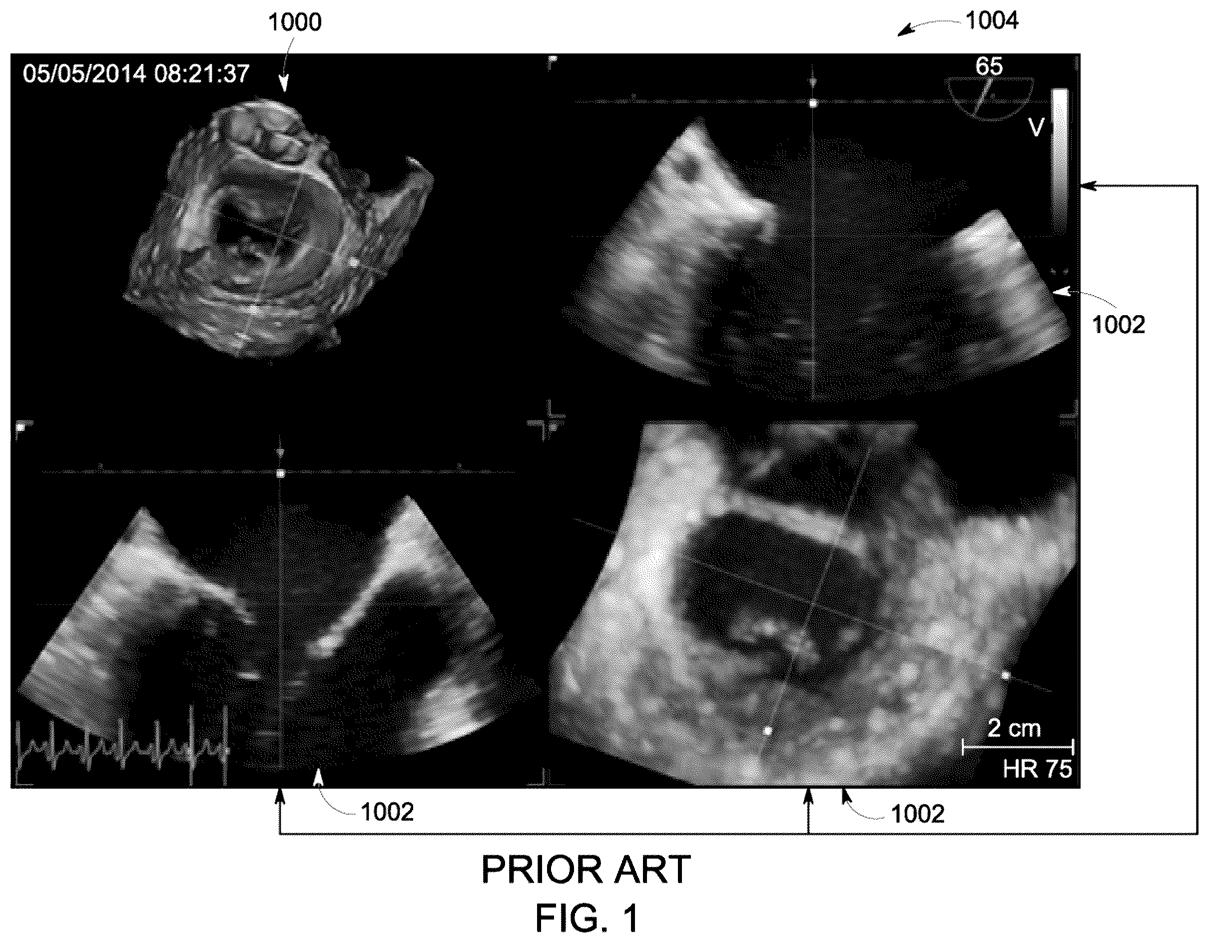 Patent US12504535 Figure 1 – System and method for anatomically aligned multi-planar reconstruction views for ultrasound imaging using a geometrical model