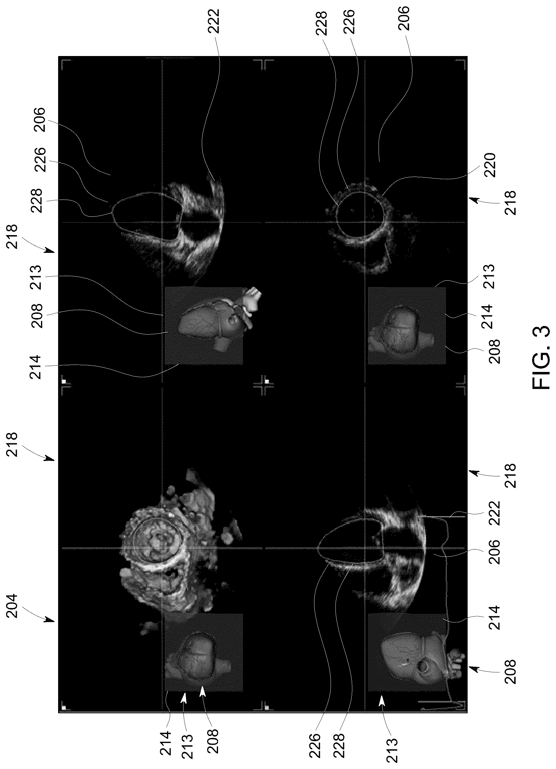 Patent US12504535 Figure 3 – System and method for anatomically aligned multi-planar reconstruction views for ultrasound imaging using a geometrical model