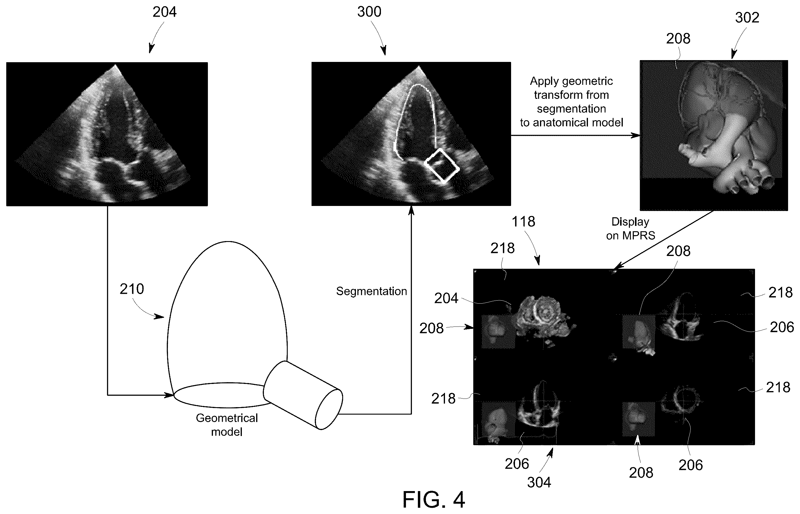 Patent US12504535 Figure 4 – System and method for anatomically aligned multi-planar reconstruction views for ultrasound imaging using a geometrical model