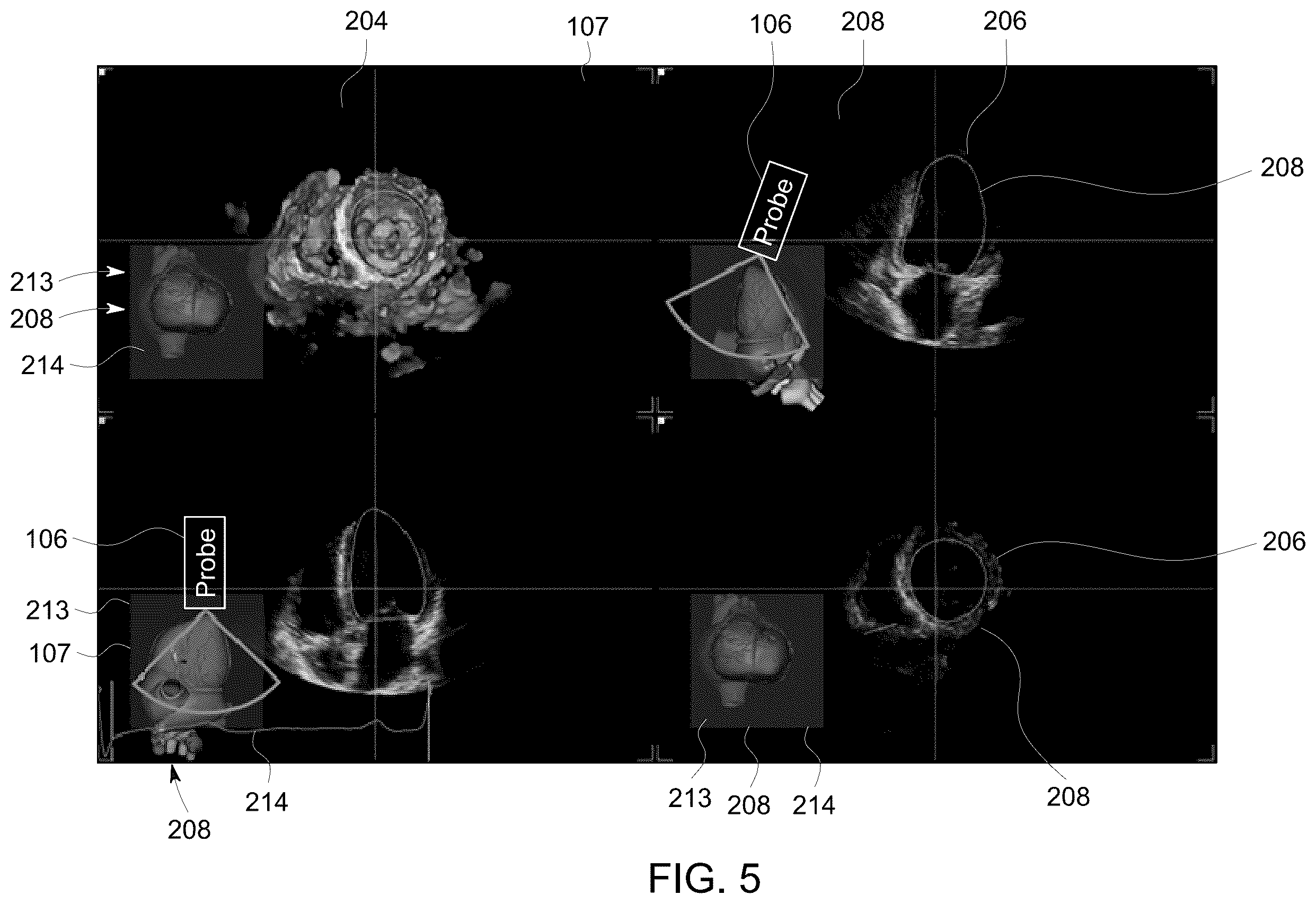 Patent US12504535 Figure 5 – System and method for anatomically aligned multi-planar reconstruction views for ultrasound imaging using a geometrical model