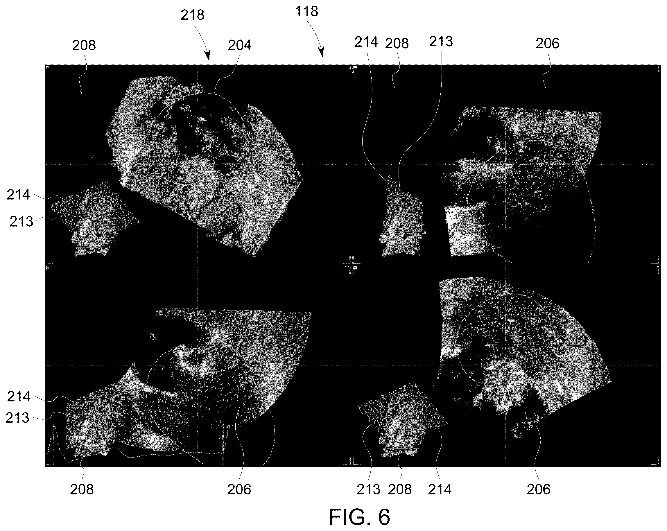 Patent US12504535 Figure 6 – System and method for anatomically aligned multi-planar reconstruction views for ultrasound imaging using a geometrical model