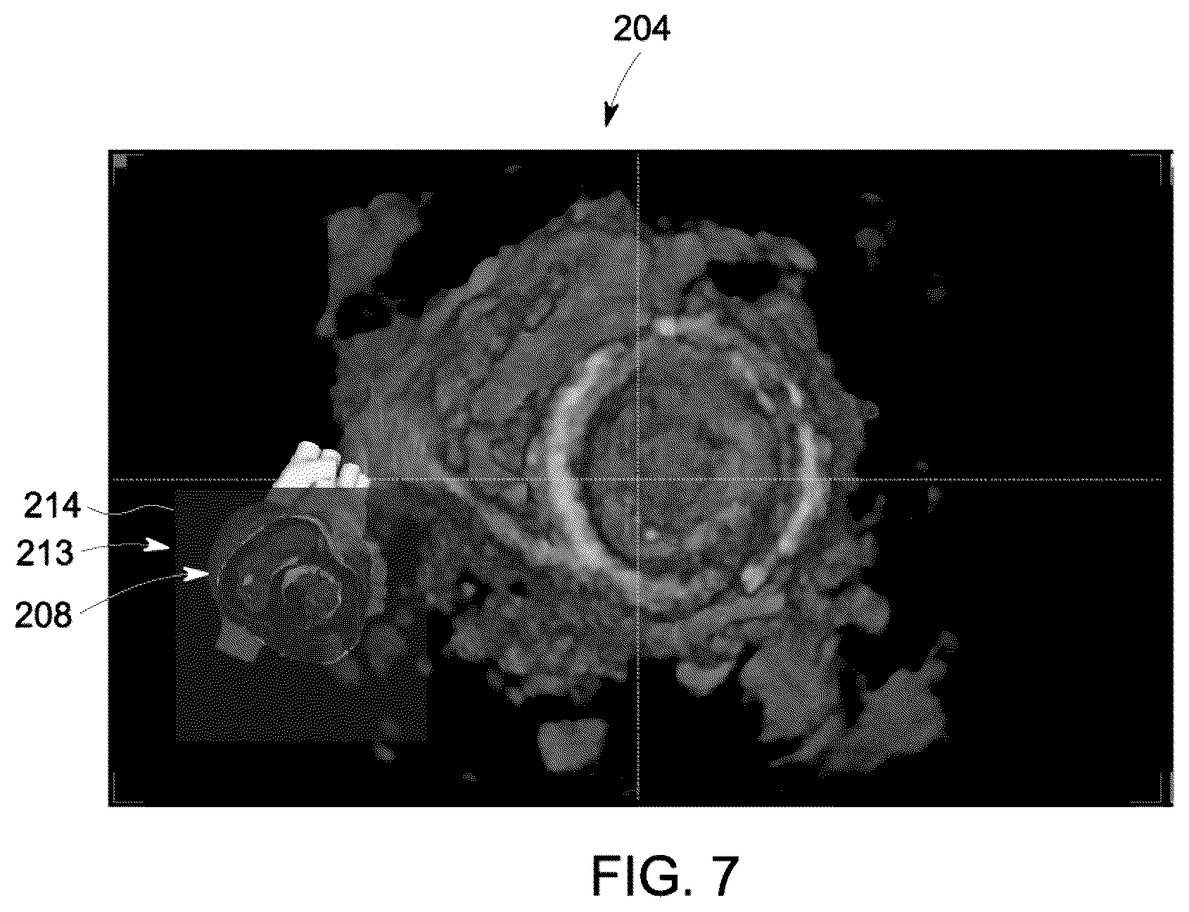 Patent US12504535 Figure 7 – System and method for anatomically aligned multi-planar reconstruction views for ultrasound imaging using a geometrical model