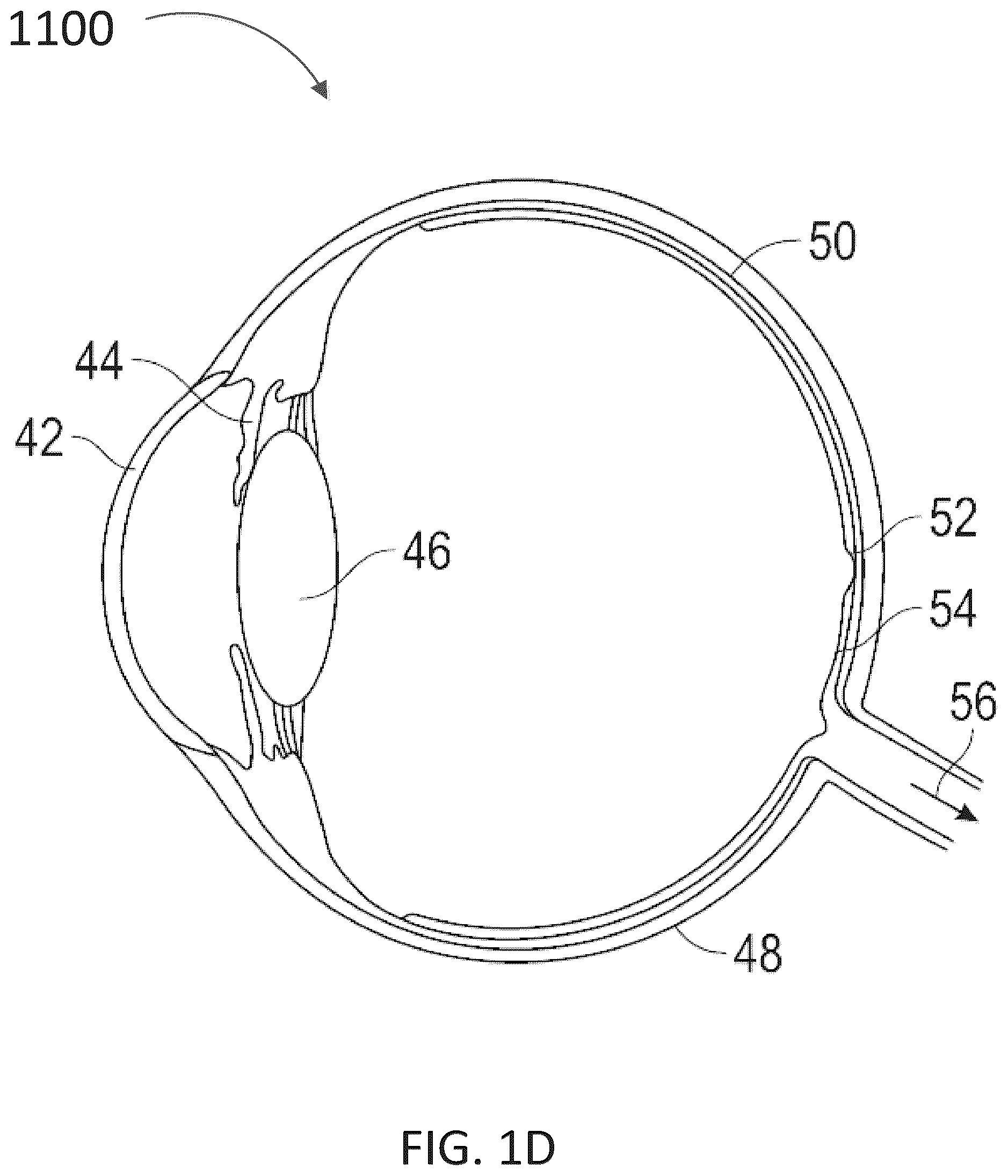 Patent US12504634 Figure 4 – Imaging modification, display and visualization using augmented and virtual reality eyewear