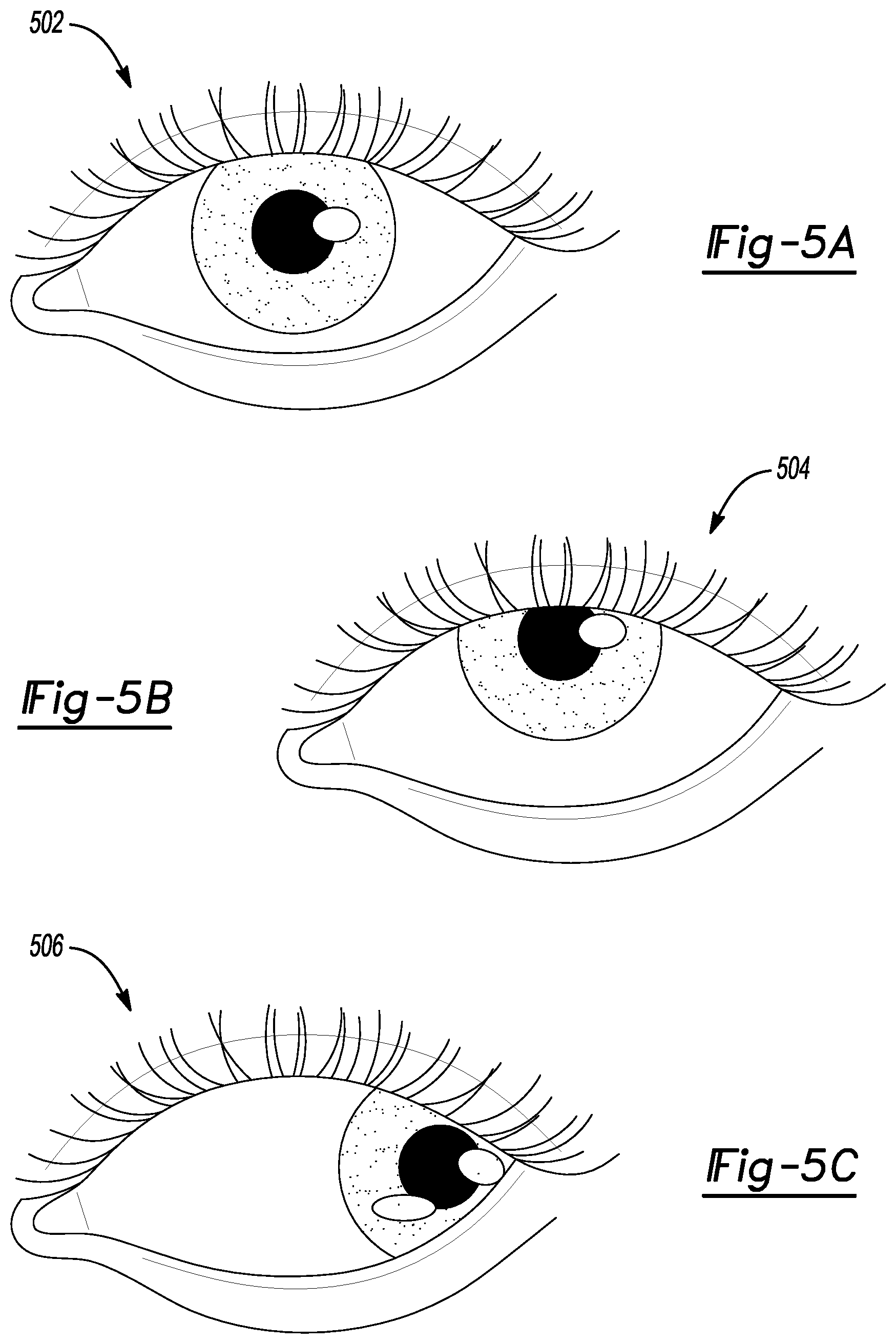 Patent US12504936 Figure 4 – Windshield having zonal displays