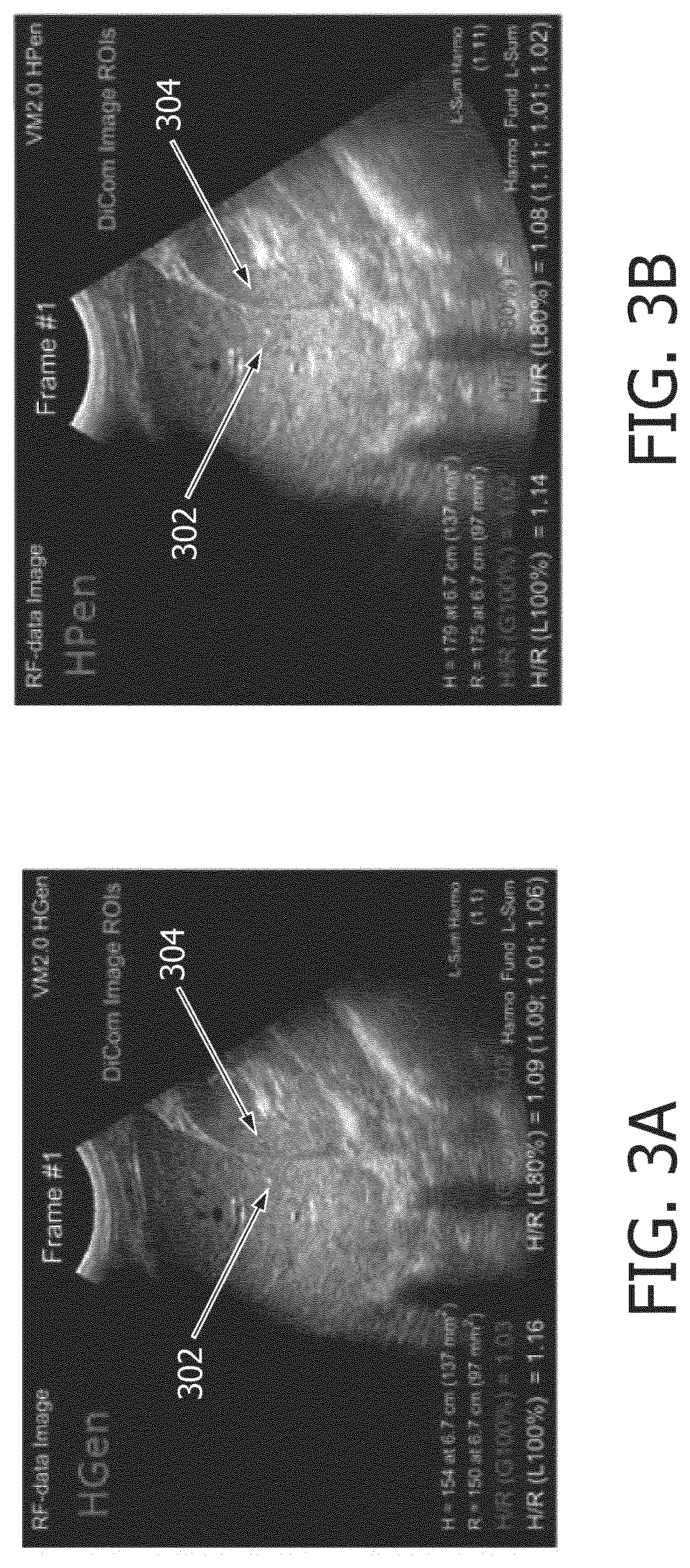 Patent US12508000 Figure 3 – Systems and methods for finding hepato-renal indices