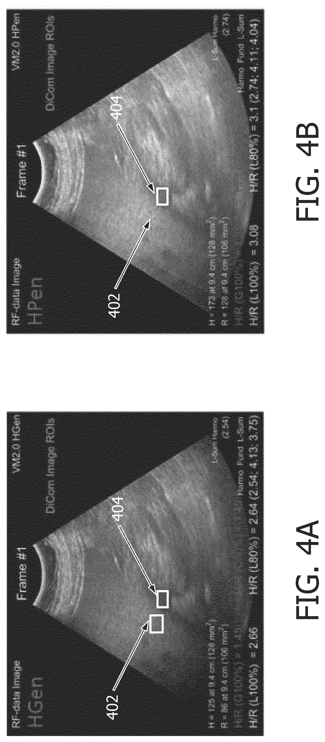 Patent US12508000 Figure 4 – Systems and methods for finding hepato-renal indices